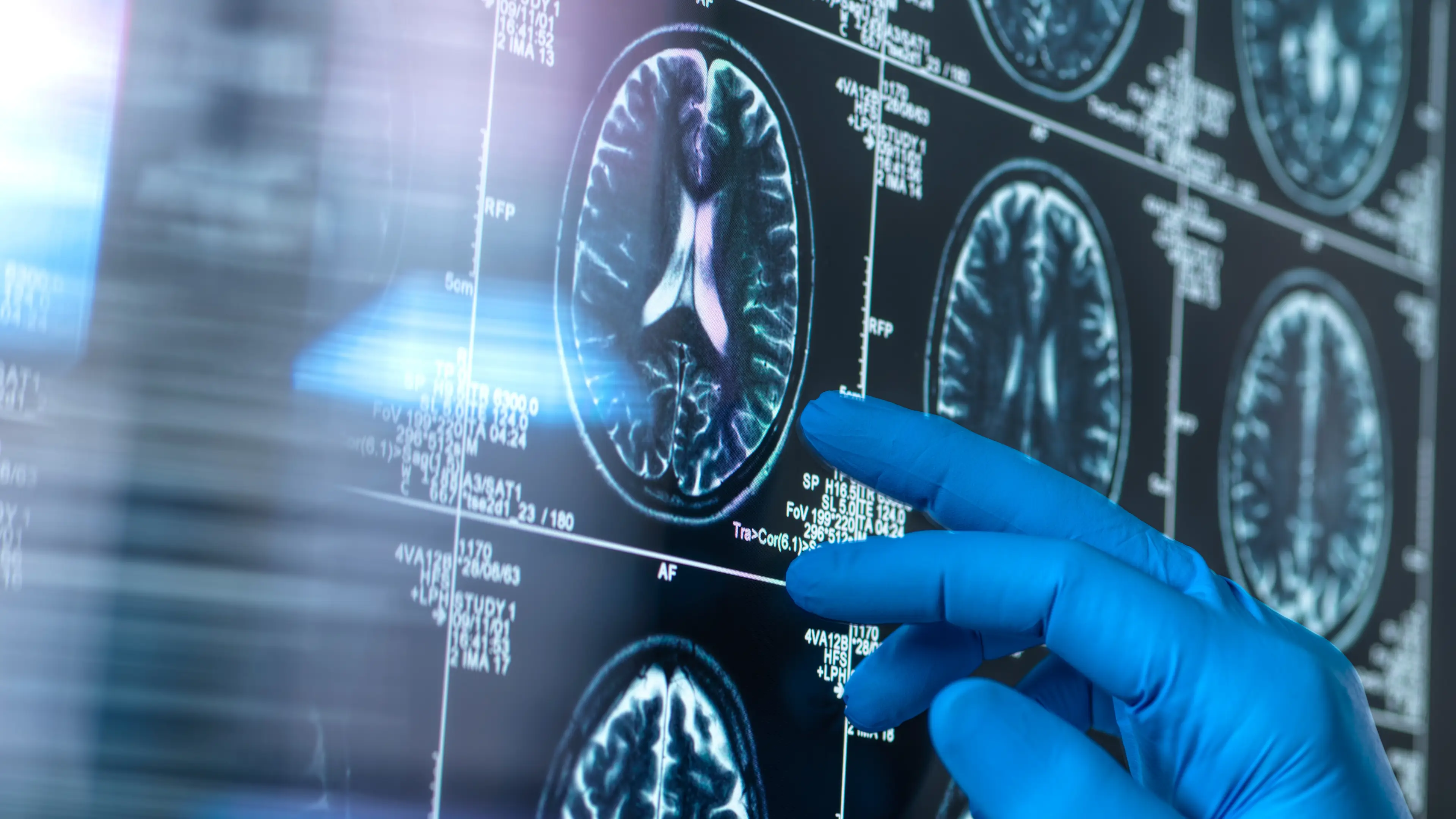 (Getty Images/Science Photo Library)