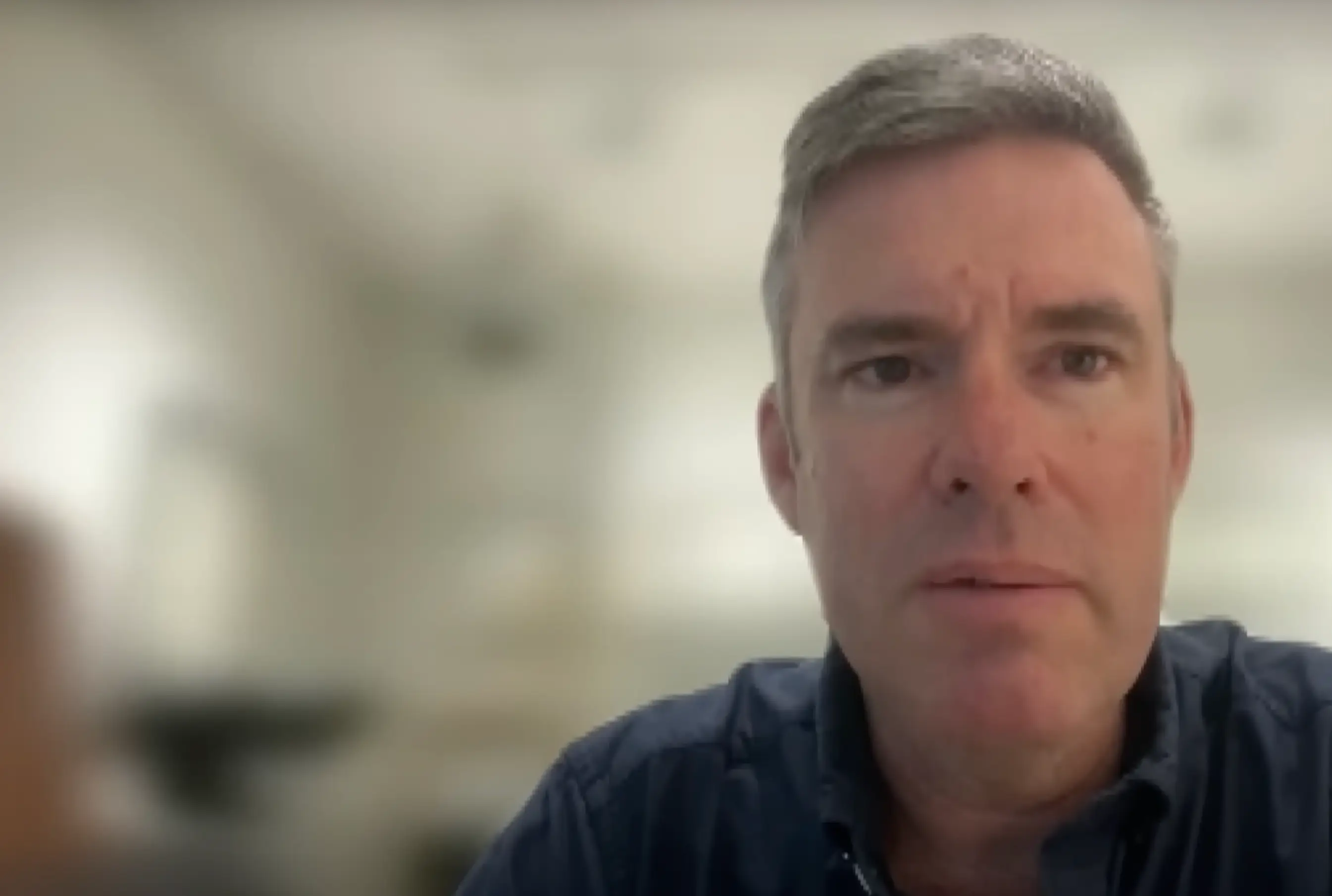 Dr Greg Moloney from Vancouver's Mount Saint Joseph Hospital performed the surgery (Global News/YouTube)