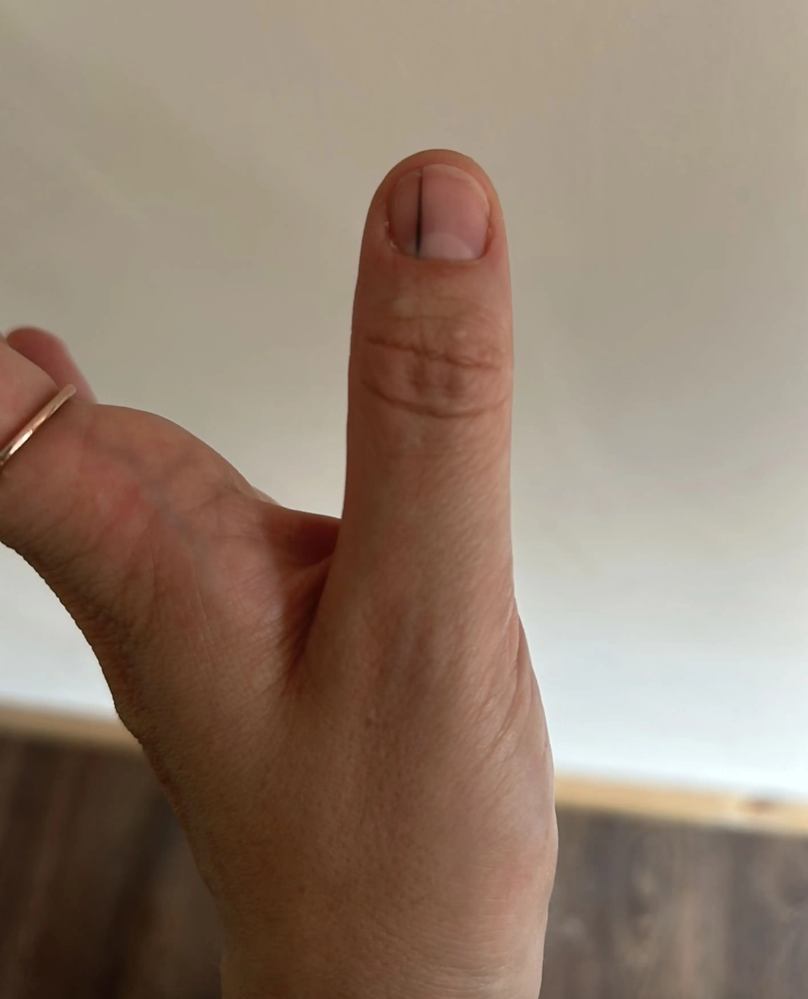 The 'funny' black line underneath Lucy's acrylic nail turned out to be first sign of cancer (Kennedy News and Media)
