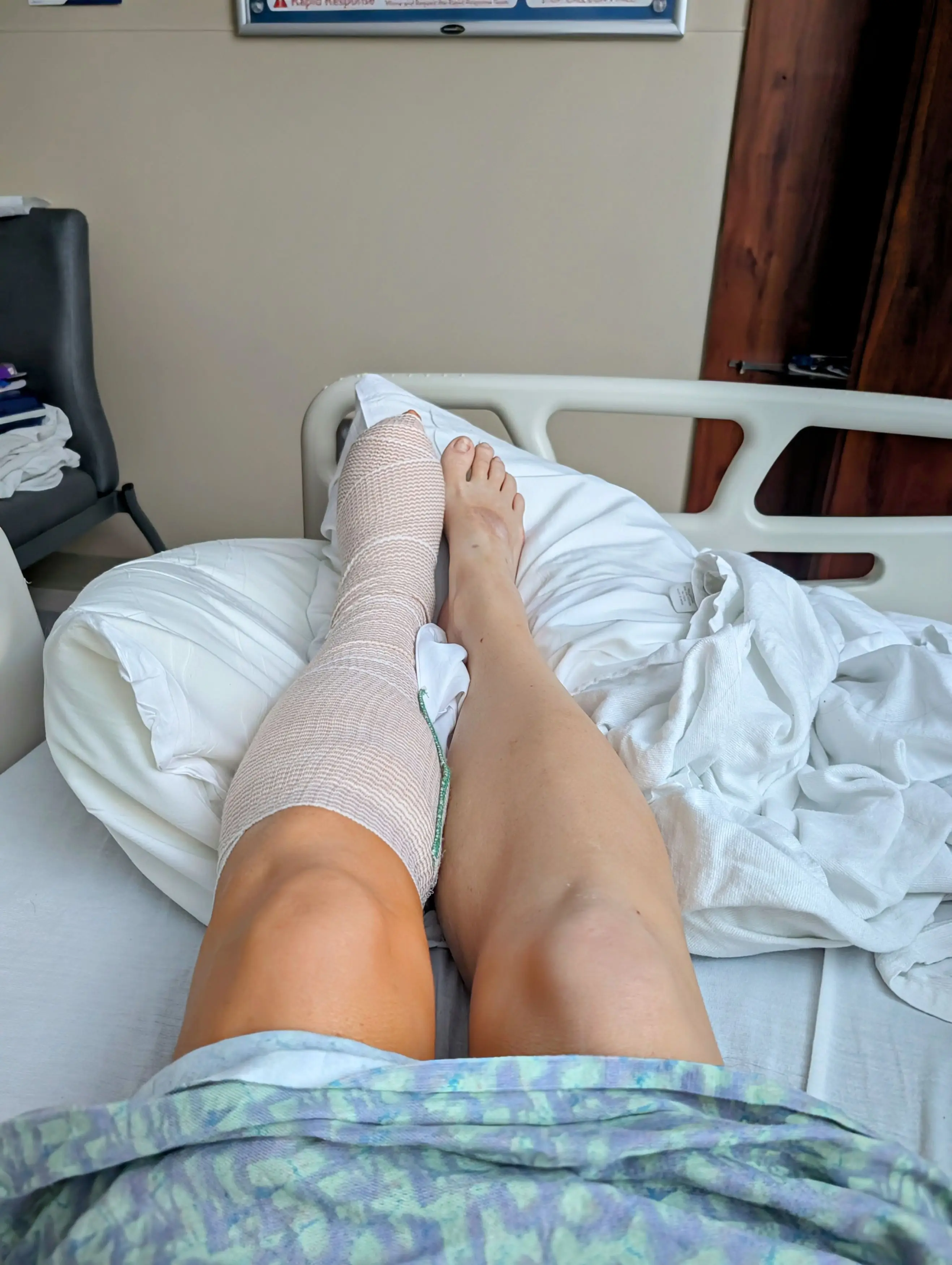 Lacey will need a prosthetic foot (Kennedy News and Media)