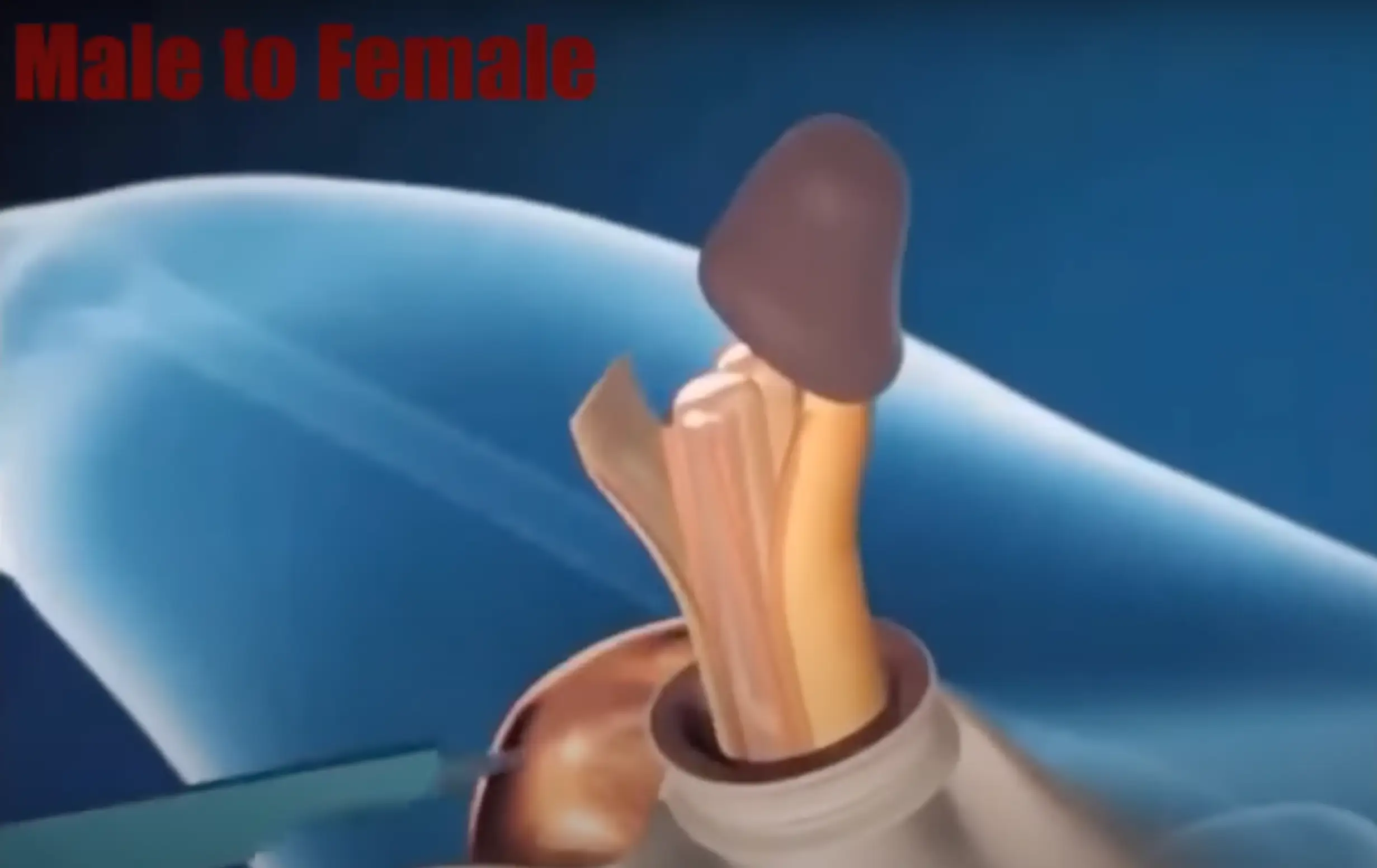The head of the penis is used to make a clitoris.