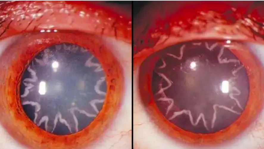 The New England Journal of Medicine