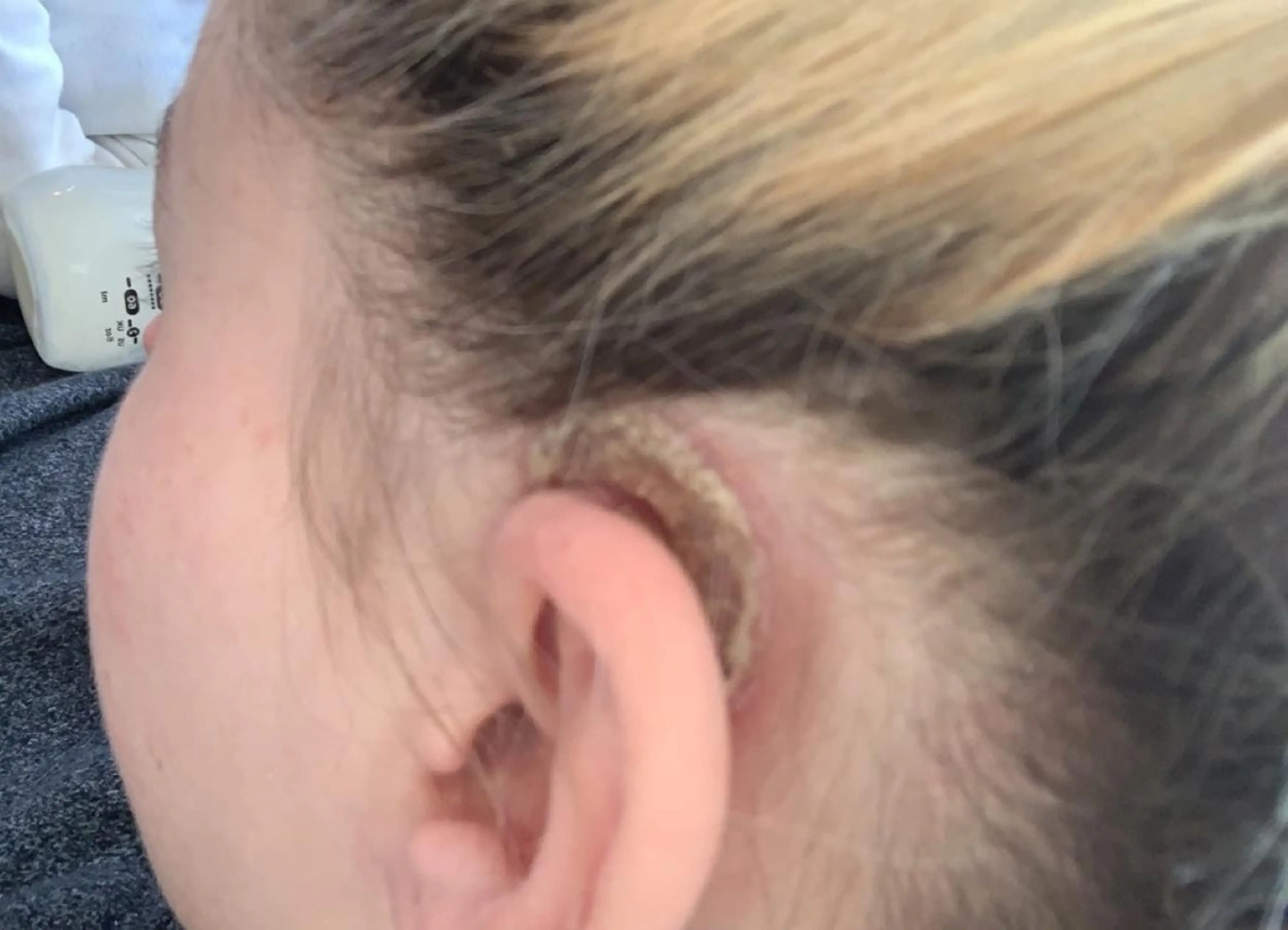 Leonie noticed a patch of dry skin behind her ear, but initially dismissed it as dandruff (Kennedy News and Media)
