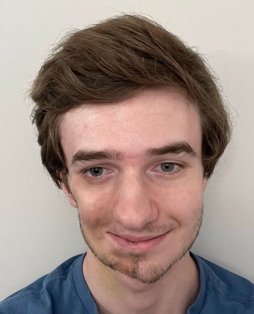 Caldwell after one of his surgeries (Instagram/@lukas.caldwell)