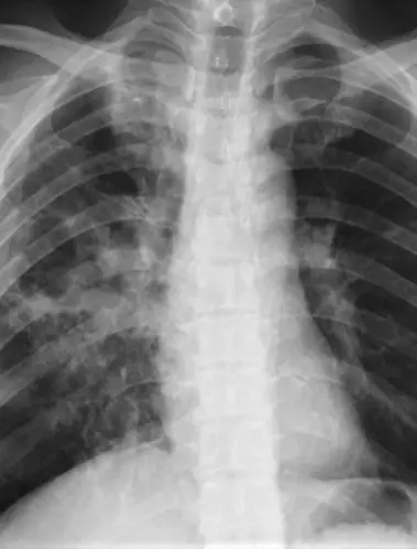 The health benefits of quitting vaping can be seen very quickly (Getty Stock Images)