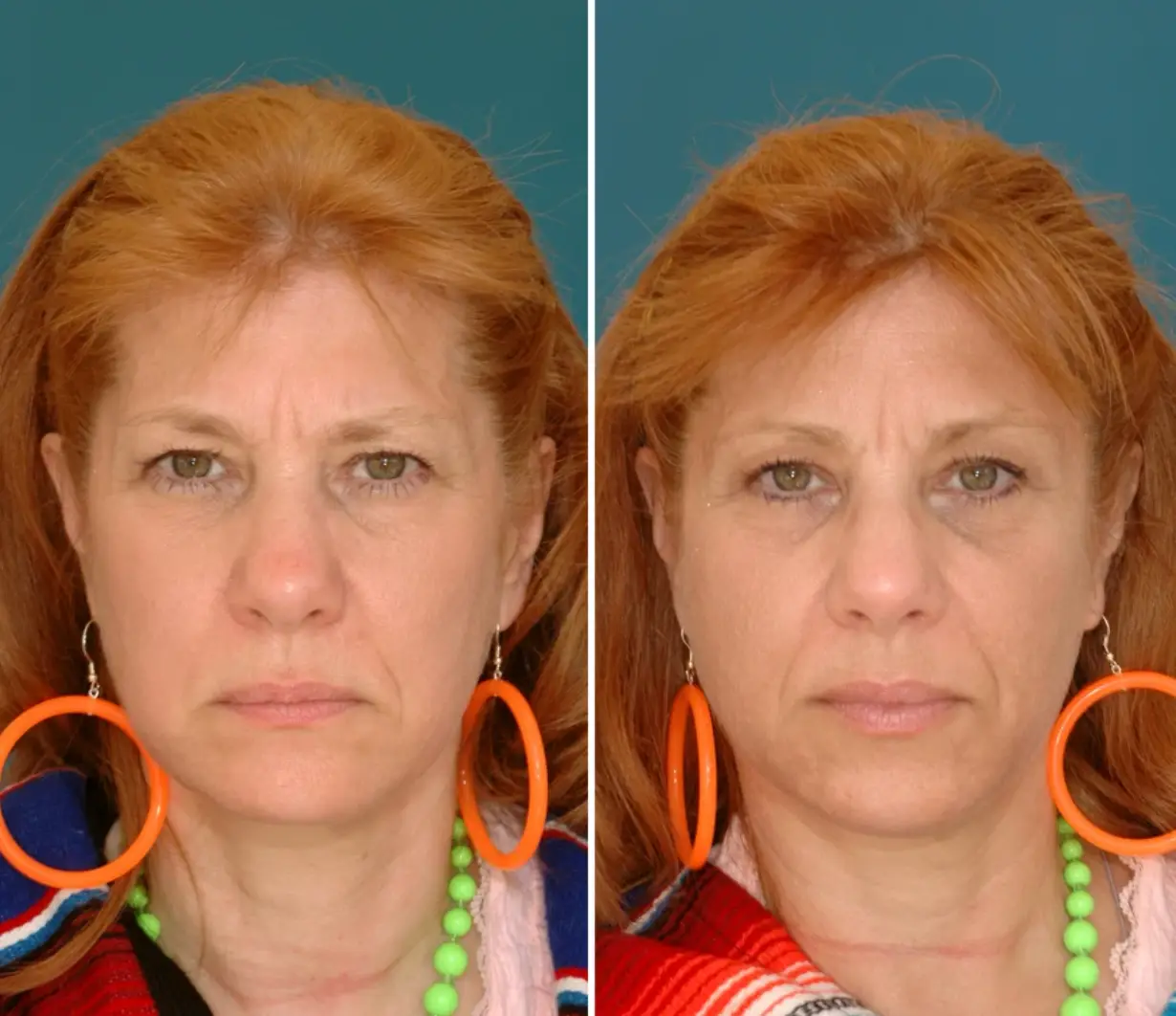 Janet and Jean, aged 54 (NBC)