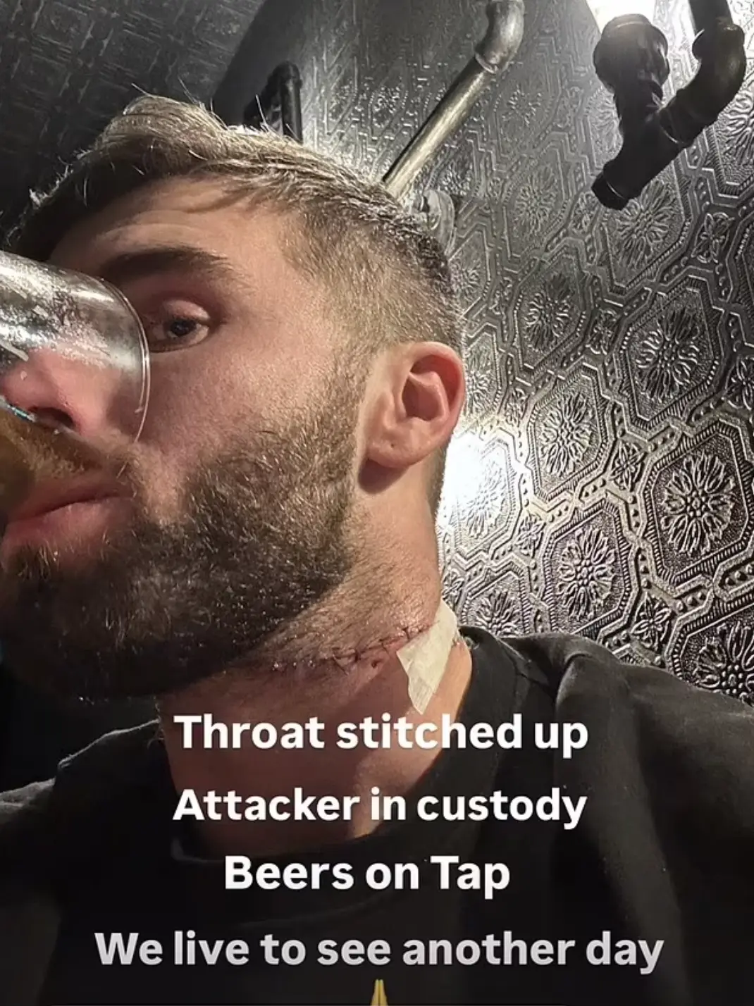 Cormac was back in the pub not too long after the attack (Instagram)