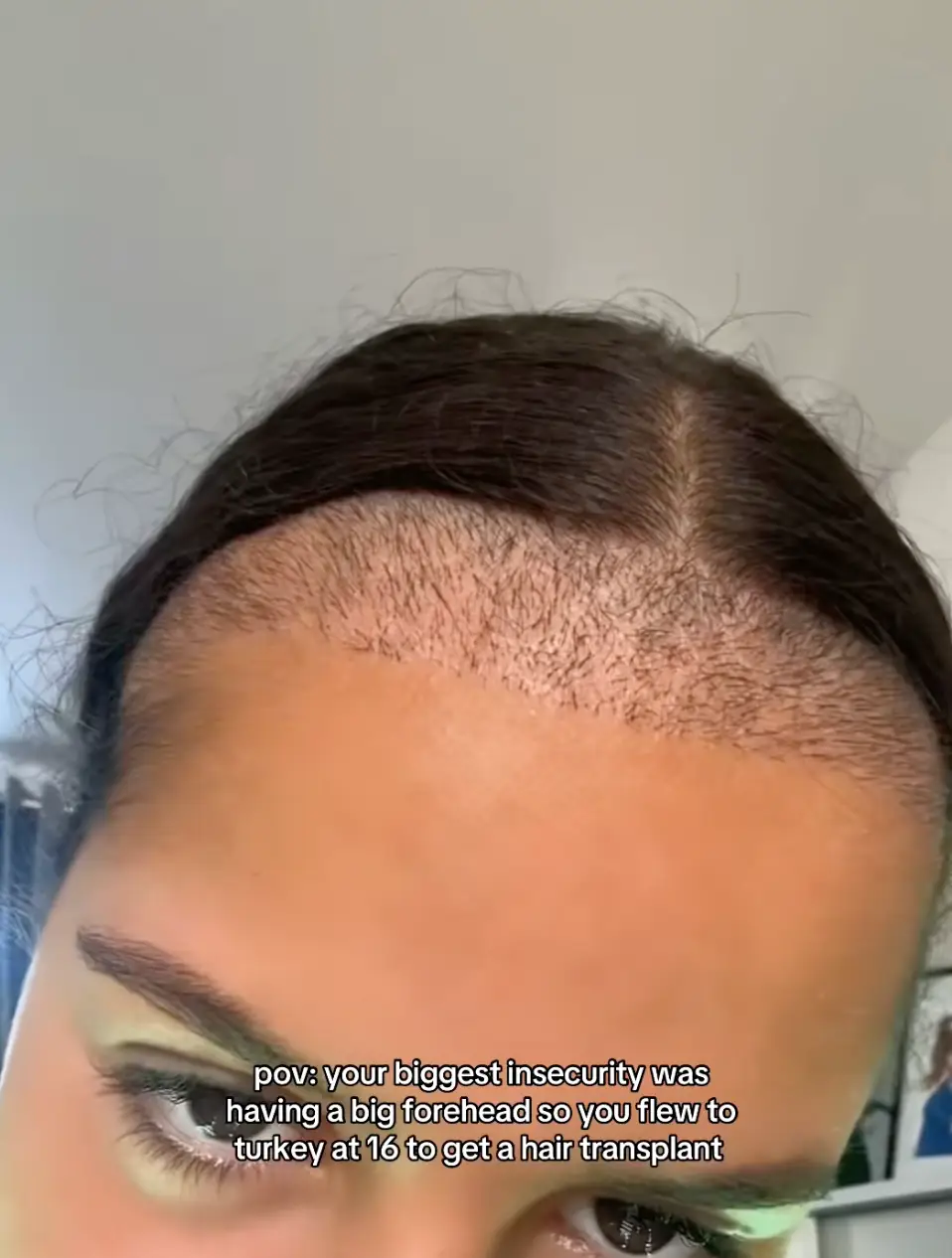 Yasmine admitted that she needed to be patient in waiting for the results (TikTok/itsyas.xo)