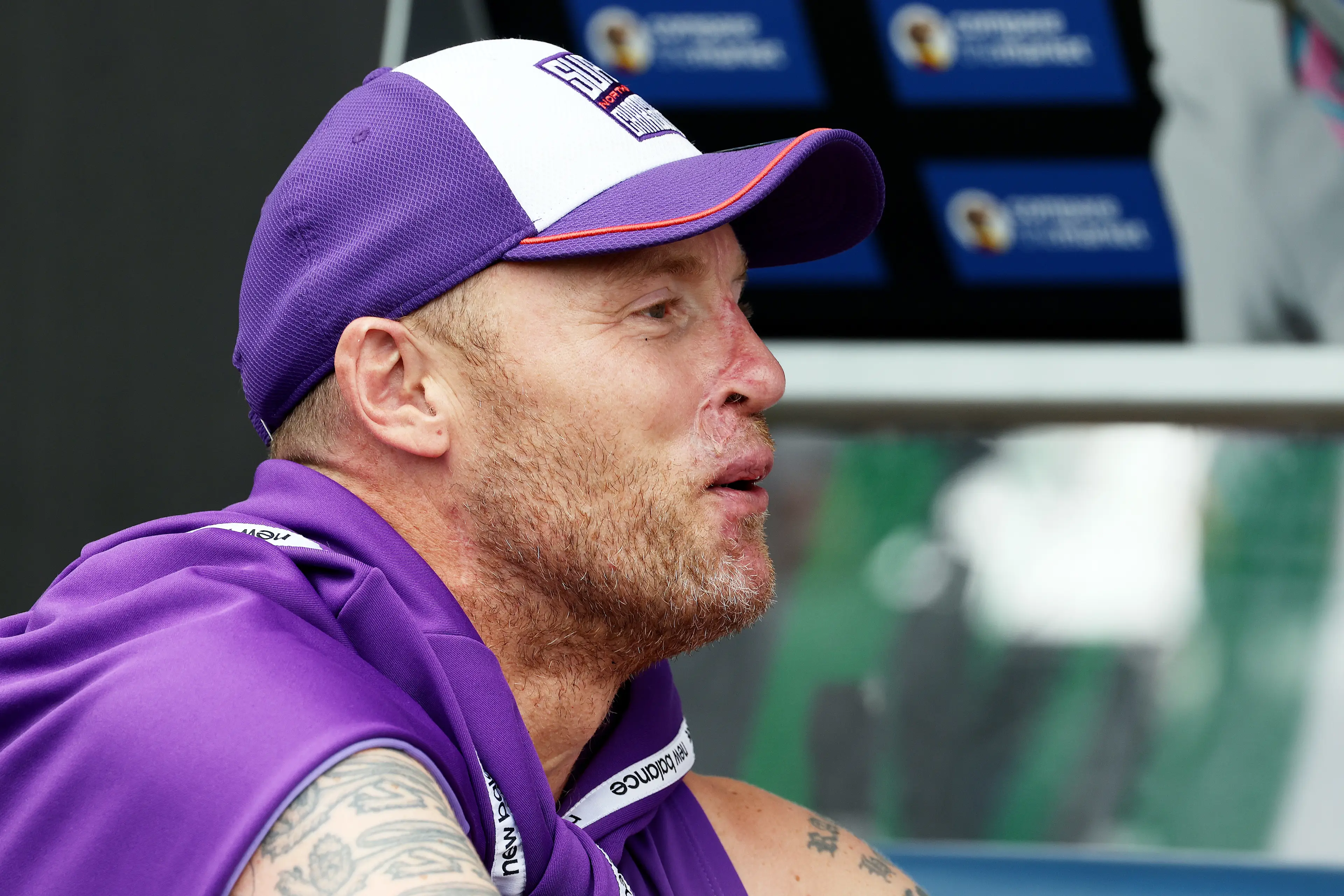The injuries can still be seen on Flintoff's face. (Nigel Roddis - ECB/ECB via Getty Images)