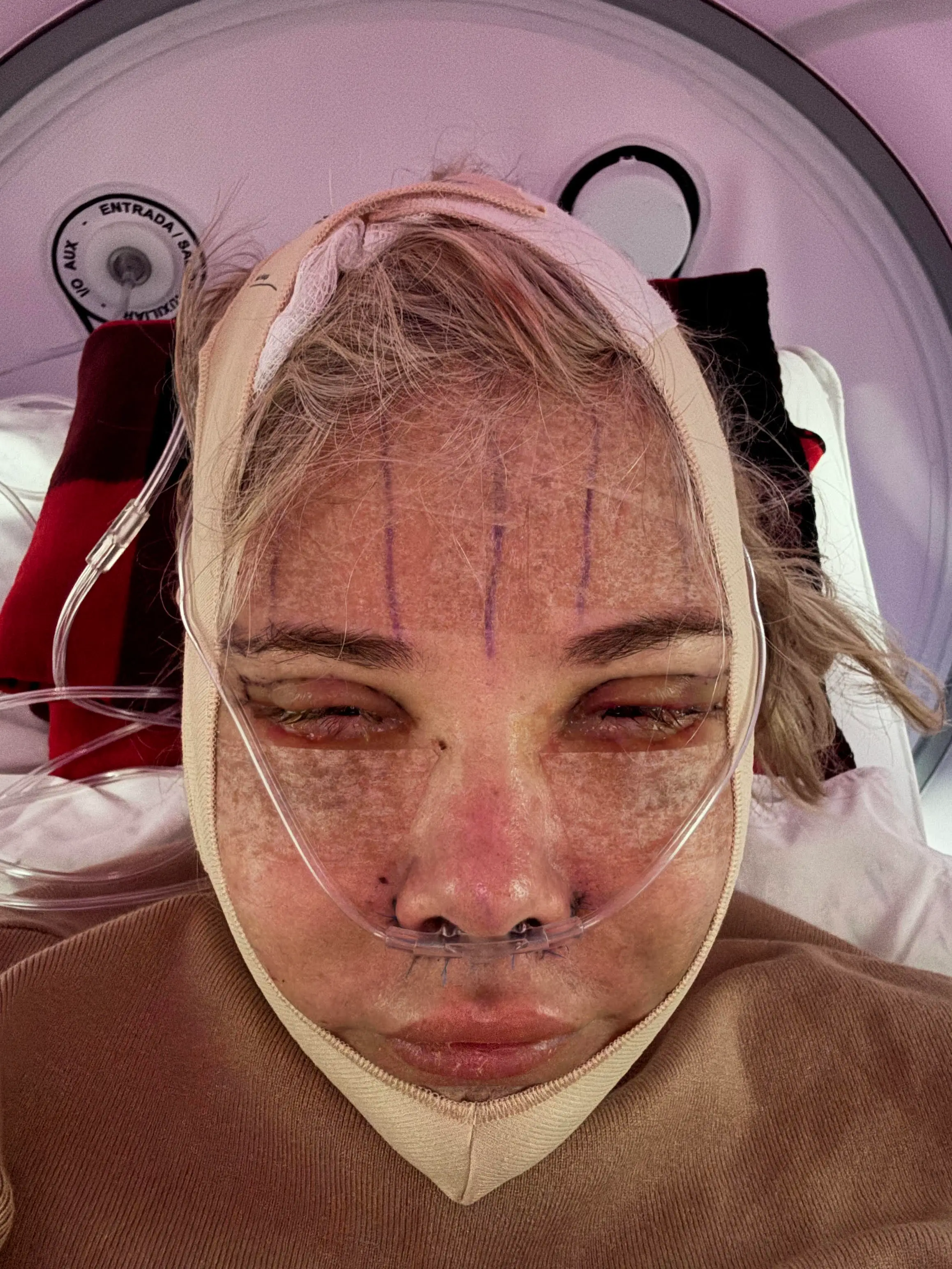 She underwent an array of procedures with a surgeon in Tijuana (PA Real Life)