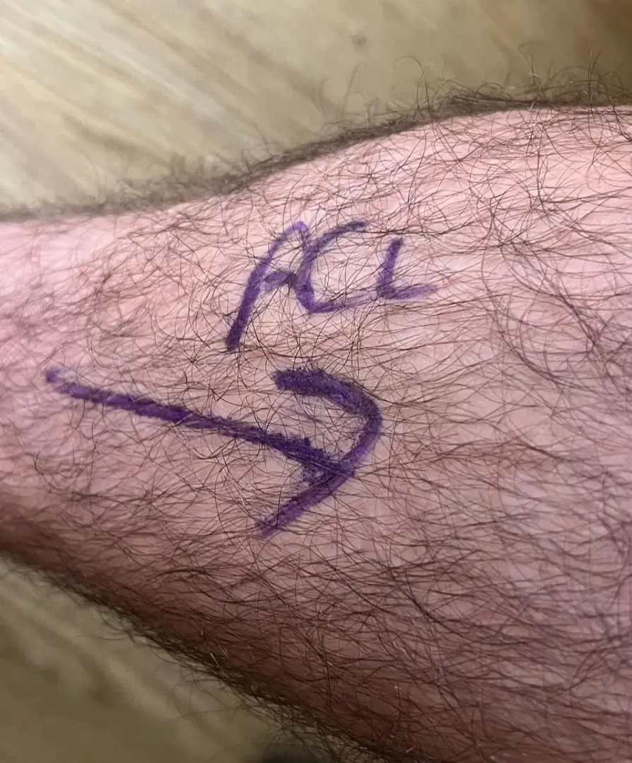 Halsall said the operation ‘went well’.