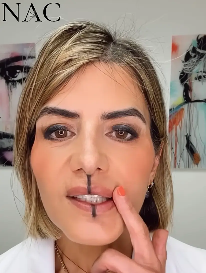 Her 'smoker's lines' were a lot less visible while her upper lip appeared fuller - but the medic admitted she preferred the untreated side (Instagram/@drbitafarrell)