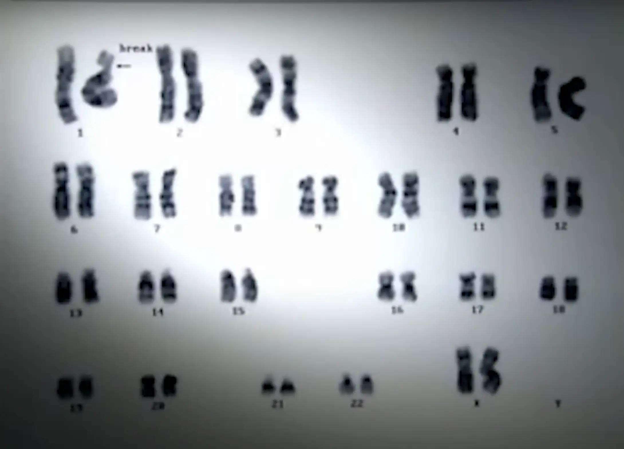 Tests revealed that his DNA had been scrambled by the radiation (Peaked Interest/YouTube)