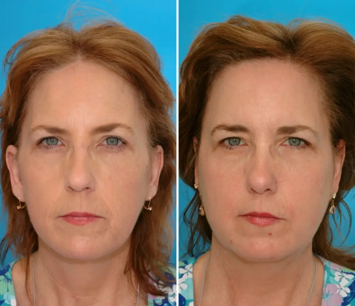 Charlotte and Rebecca, aged 48 (NBC)