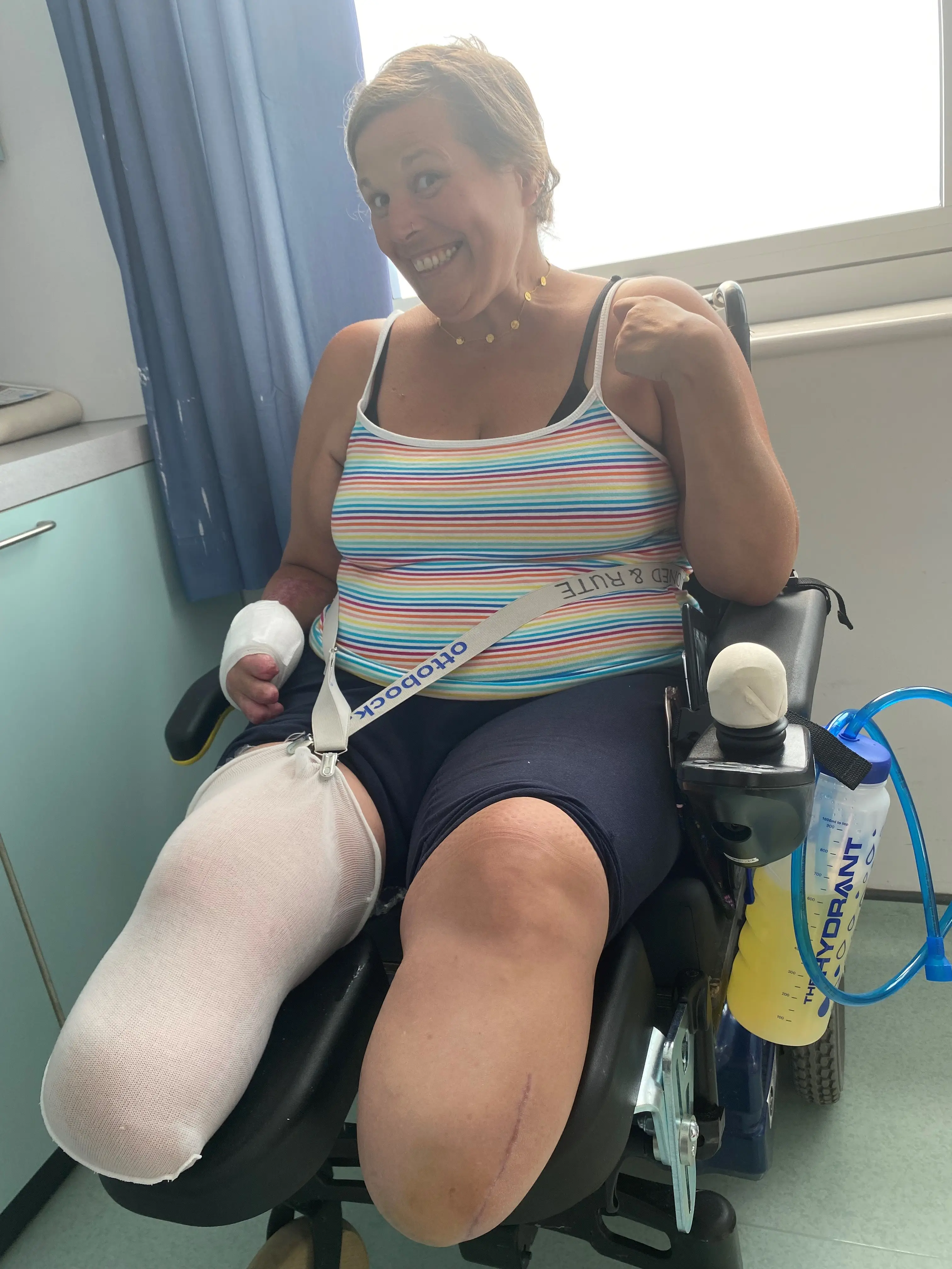 She had both of her legs amputated (Focus Features)