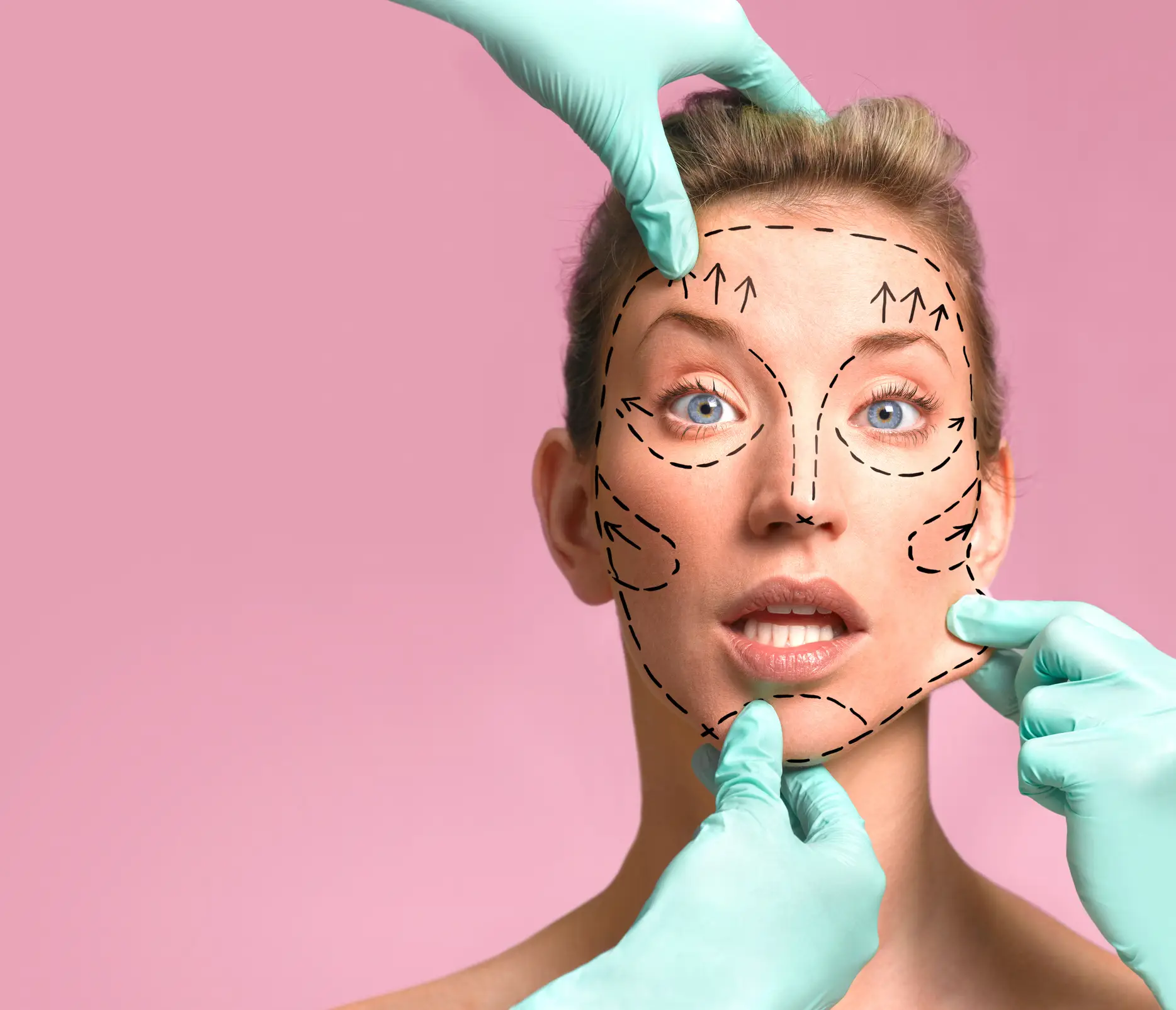 Cosmetic surgery is increasingly popular amongst Gen Z. (Getty Stock Images)