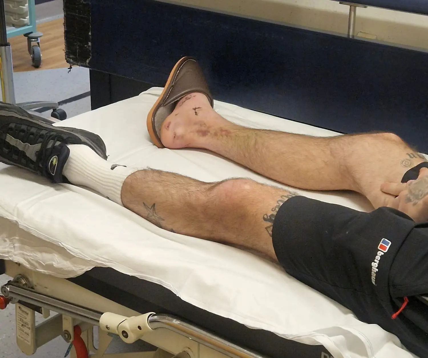 Darren and Danielle say the travel insurance firm have refused to subsidise their hospital bill SWNS)