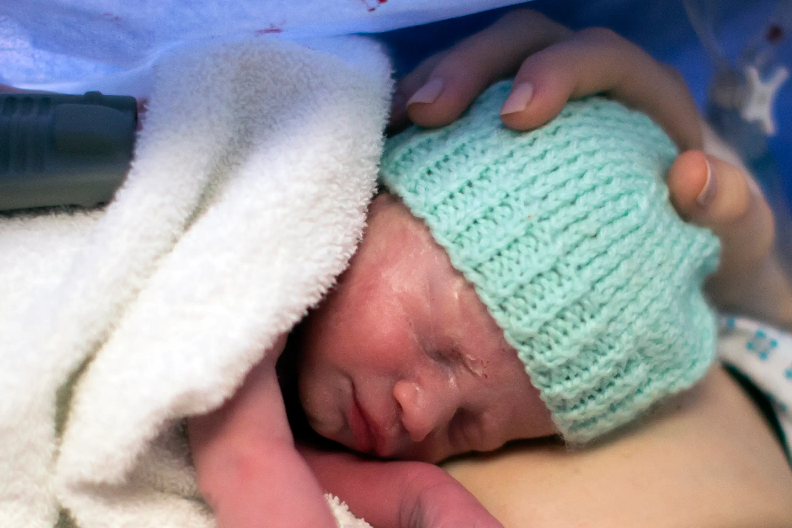 Baby Amy Isabel was born 'several weeks' early via planned c-section and weighed 4.5lb (PA)