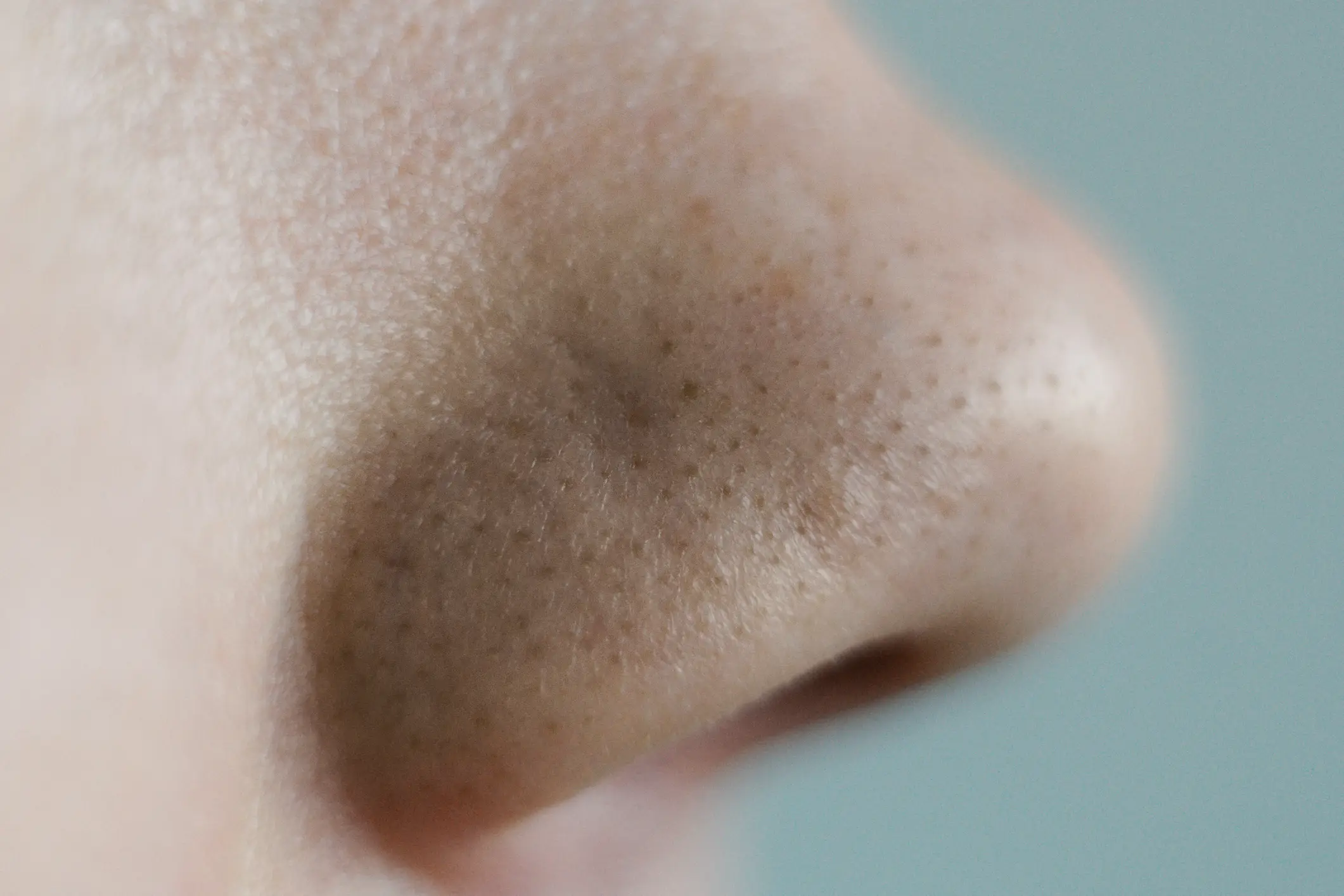 A close up of the black spots (Getty Stock)