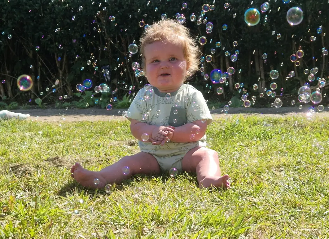 Ollie was diagnosed with the serious health condition at just two-weeks-old (GoFundMe/Jasmin Roberts)