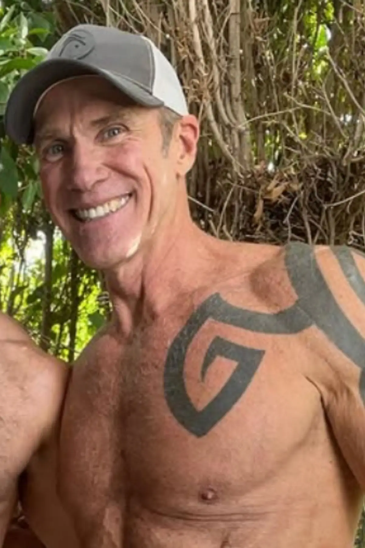 Dallas Steele said his only 'regret' was not getting the surgery sooner (Instagram/@daddy_dallassteele)