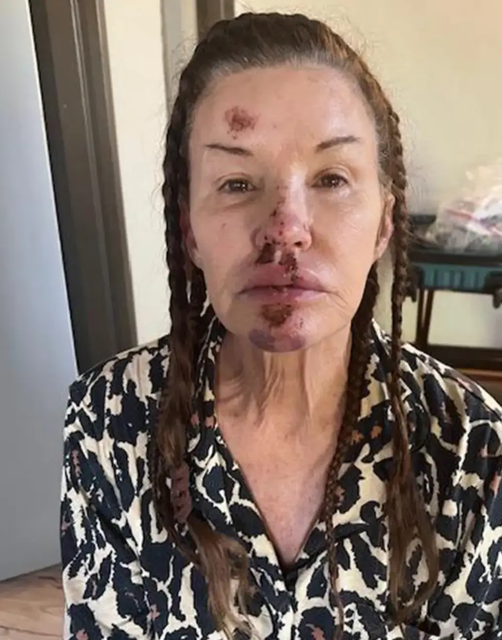 She is said to be fully committed to the legal case (Janice Dickinson)