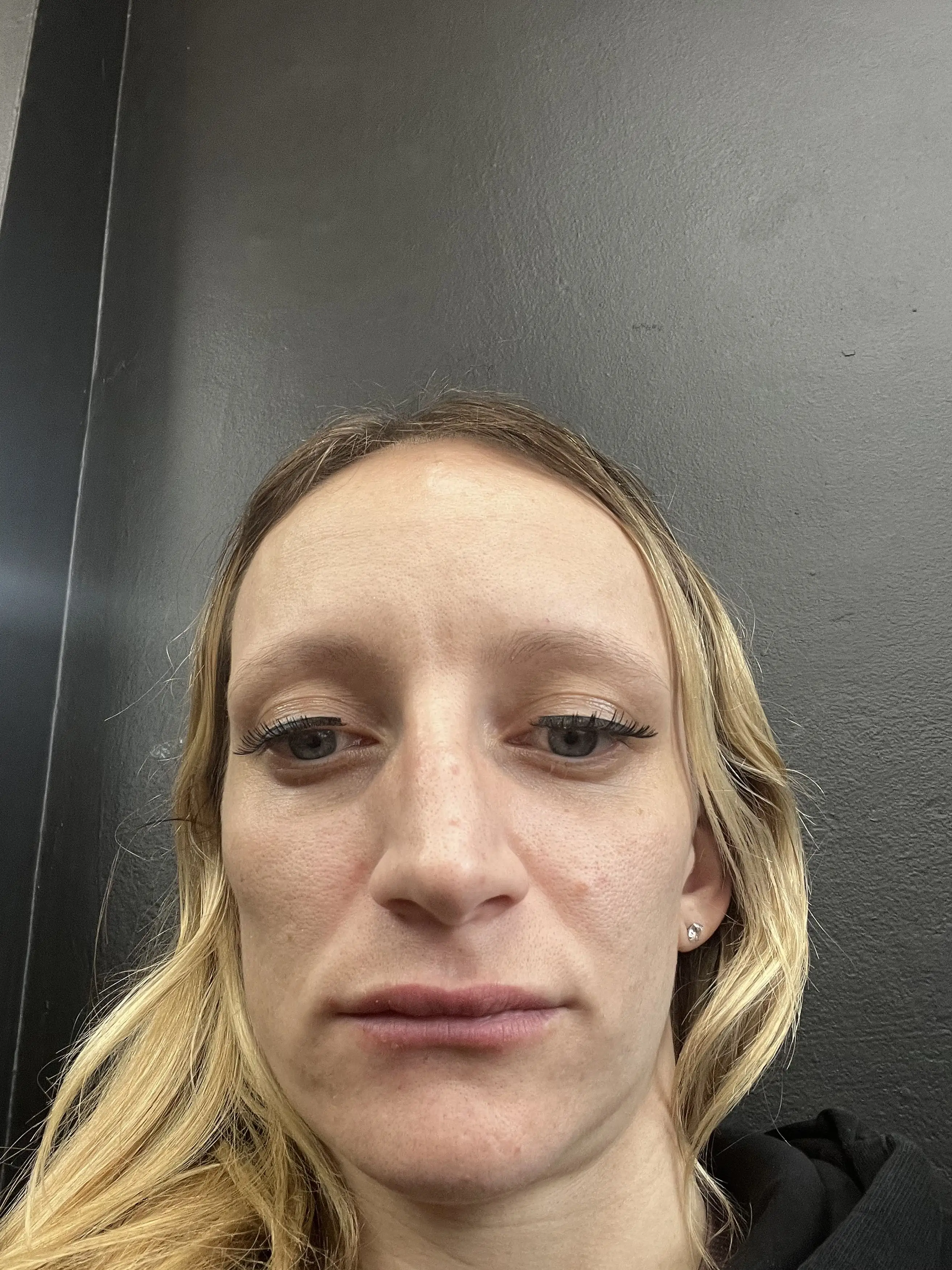 The 27-year-old would be spending as much as £2000 a month on the drug (Kennedy News and Media)
