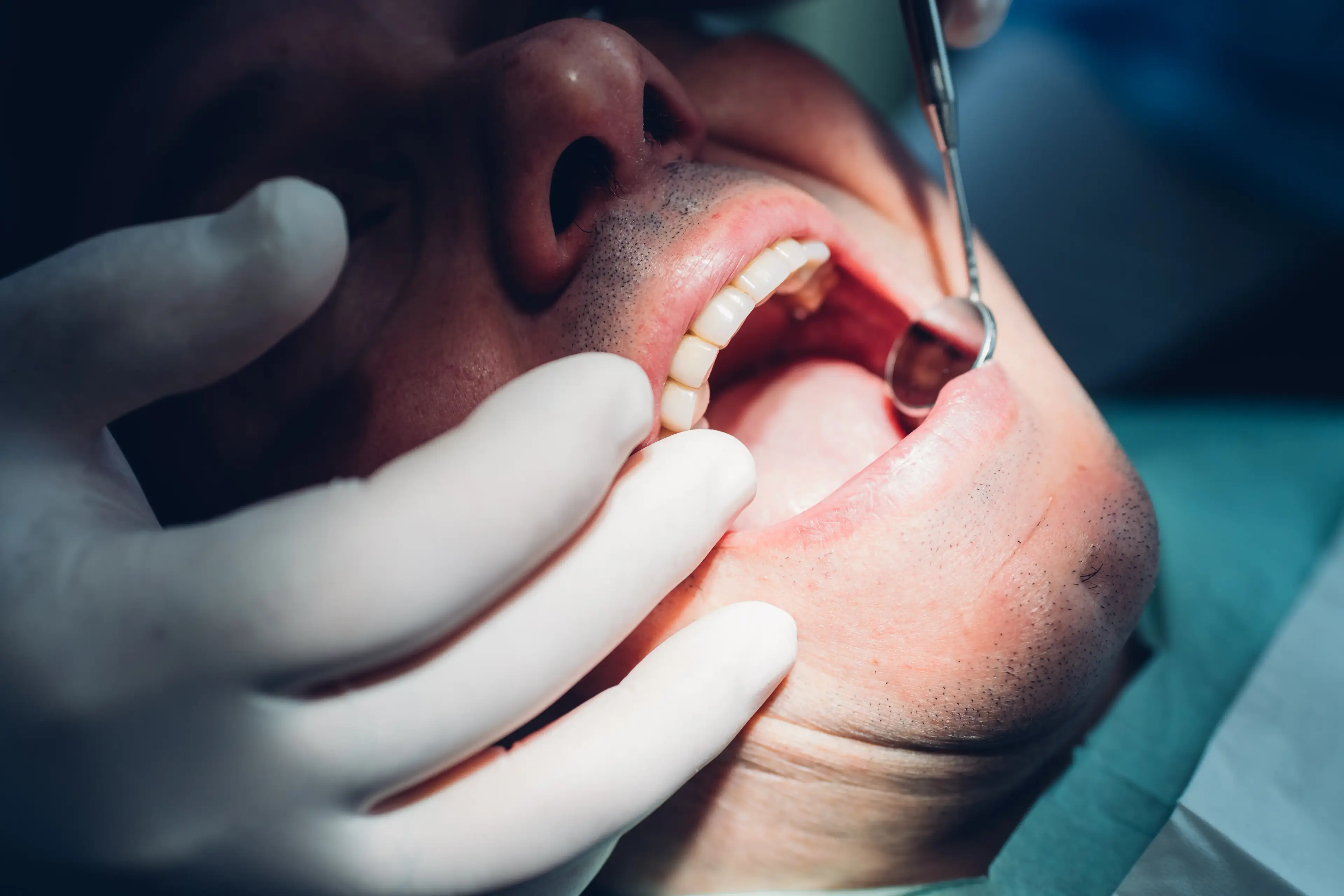 Gum disease has been linked with causing more serious diseases (Getty Stock Images)