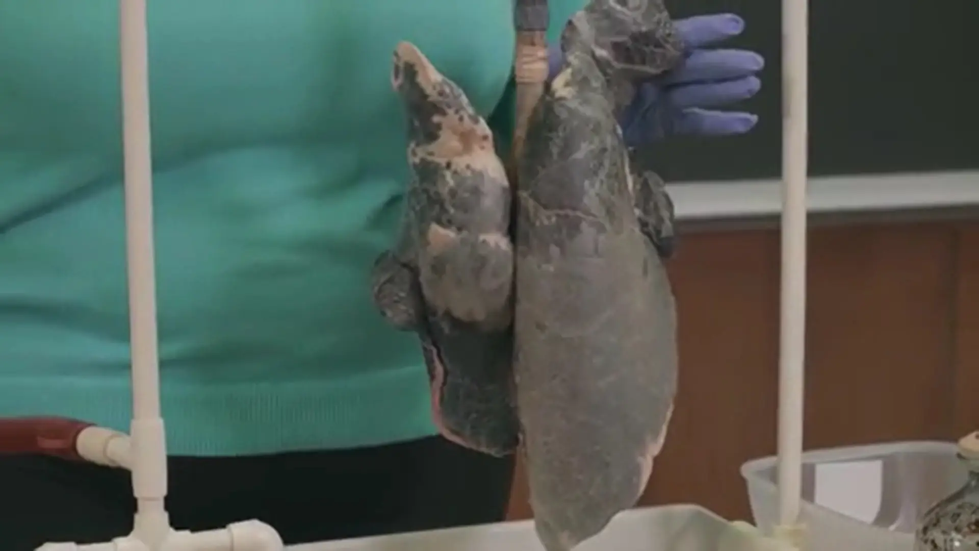 You really don't want your lungs to look like this.