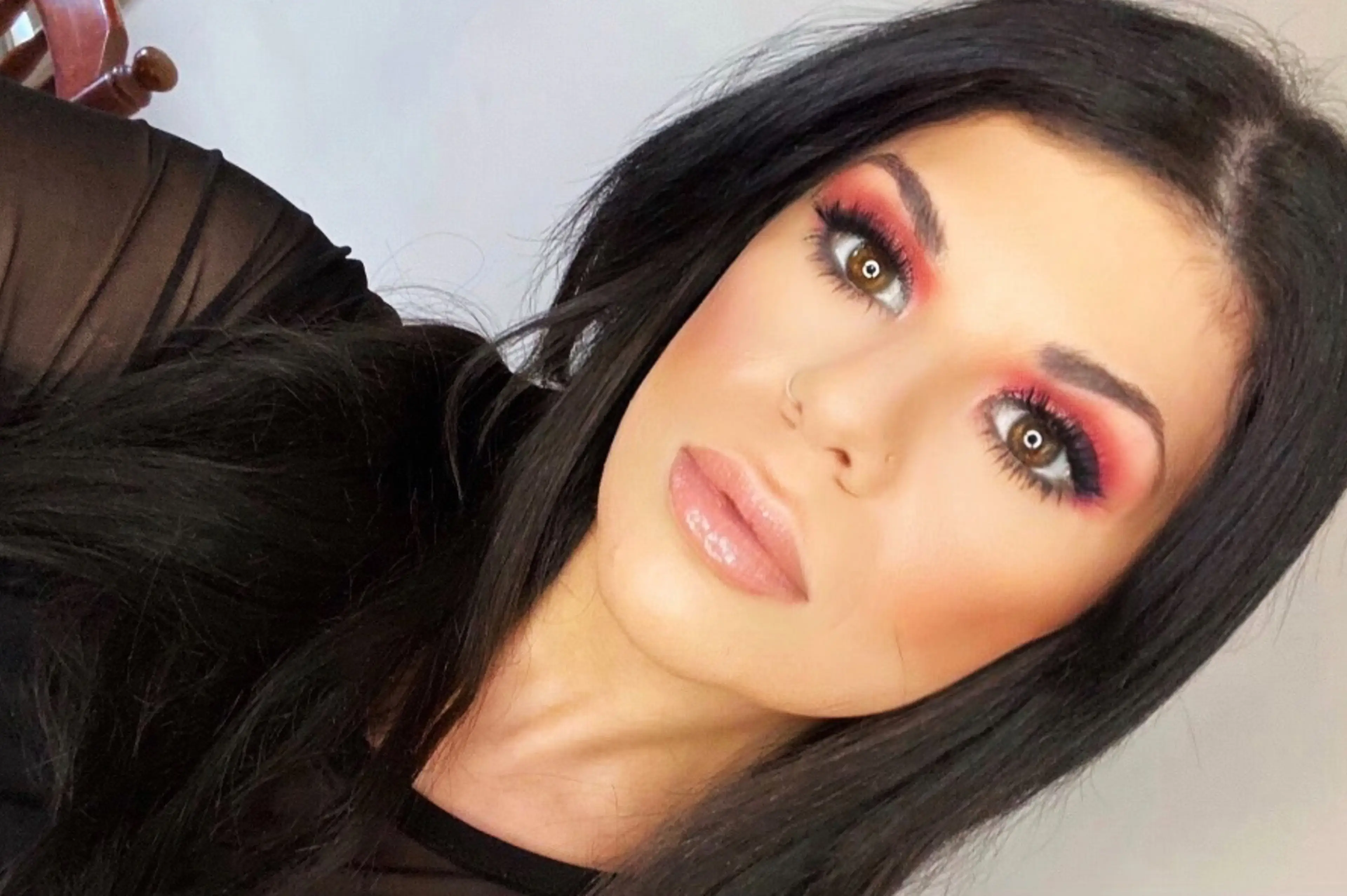 Mel has since had the extra organs removed (Caters/@‌mychroniclife_) 