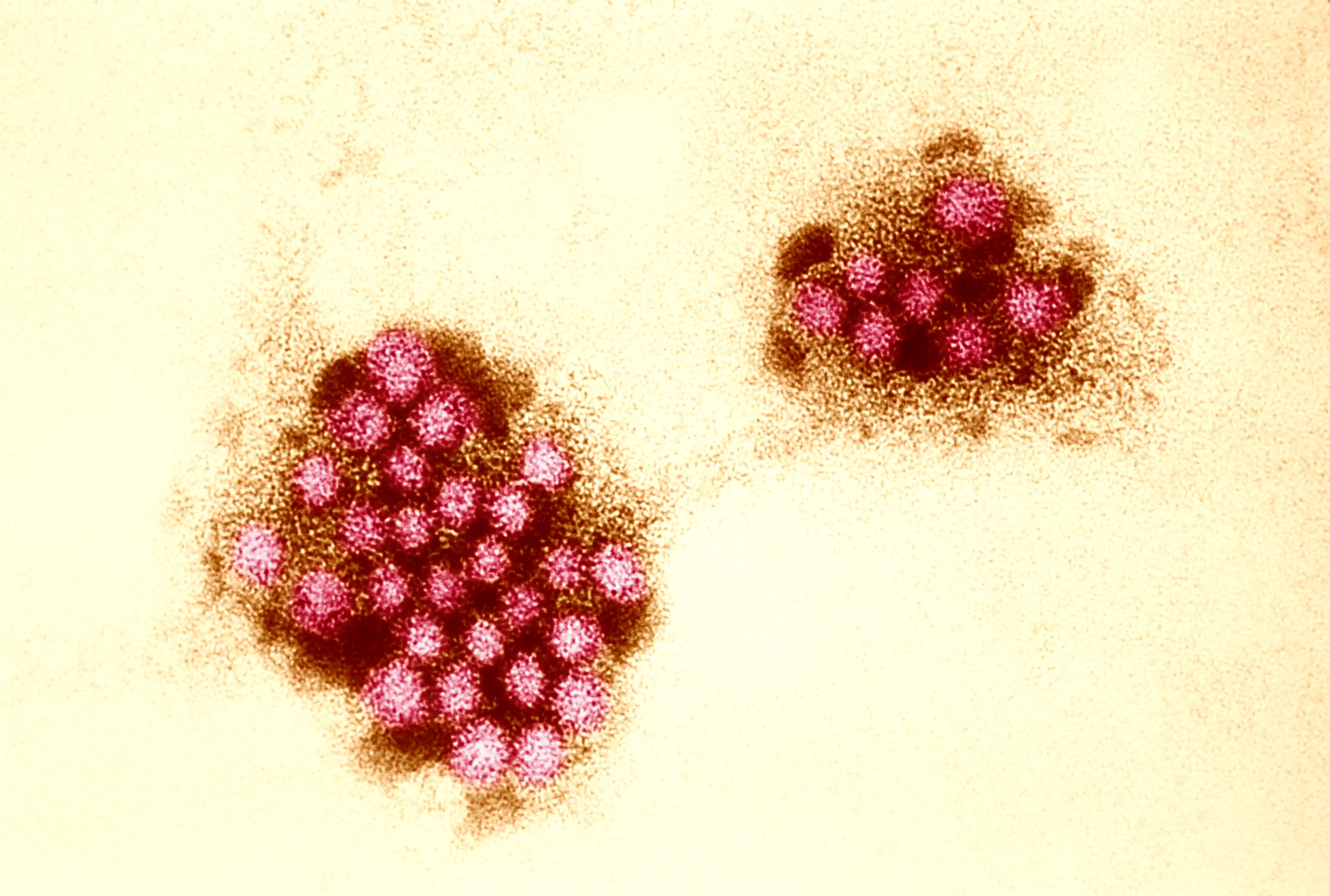 Norovirus close up under a microscope (BSIP/UIG Via Getty Images)