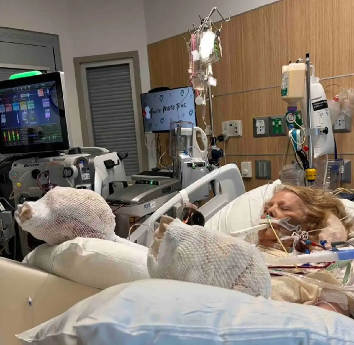 Summer is now facing further operations and a lengthy recovery (GoFundMe)