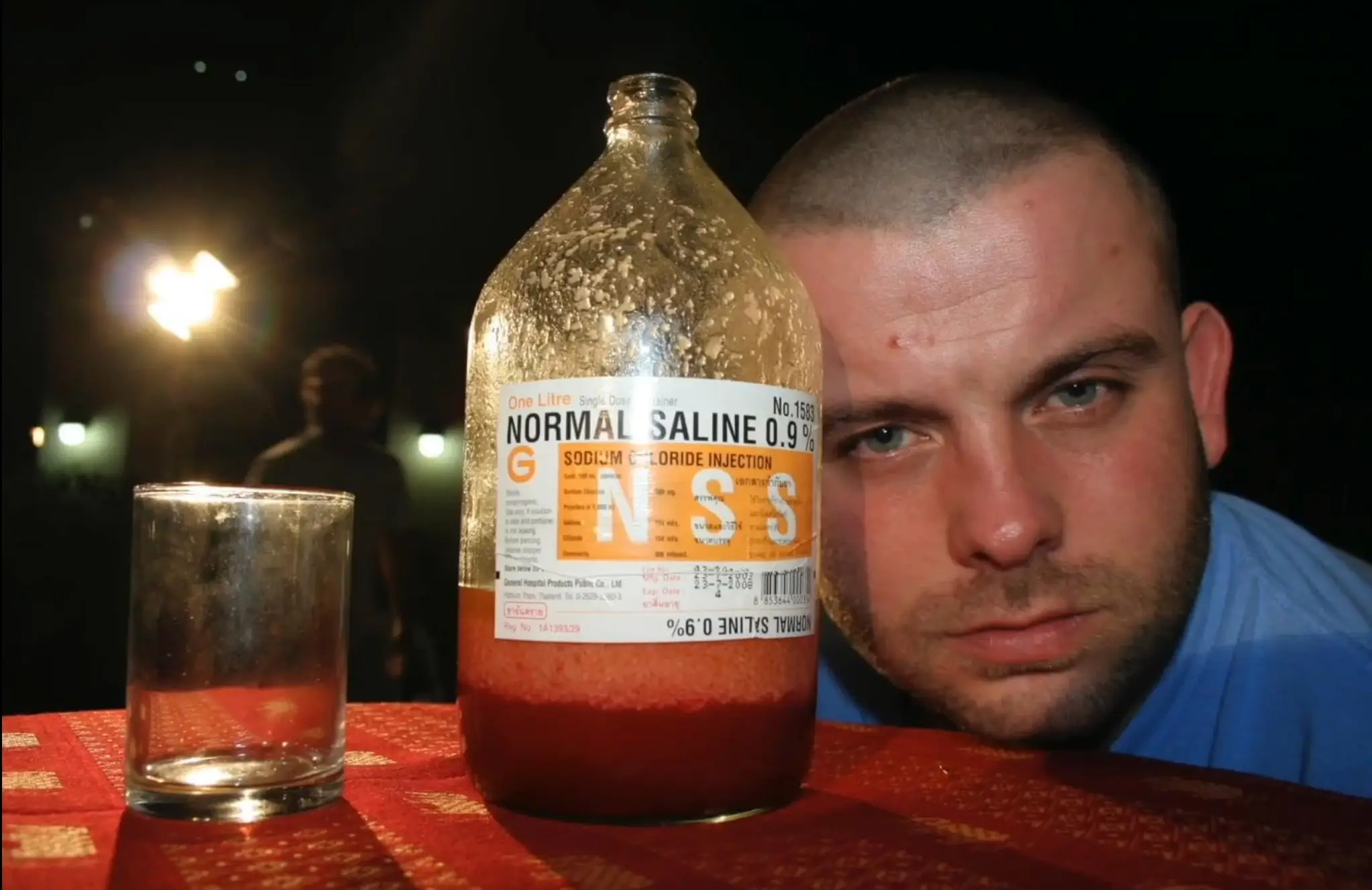 Pancho with a jar full of his own fat post-liposuction (Pathe)