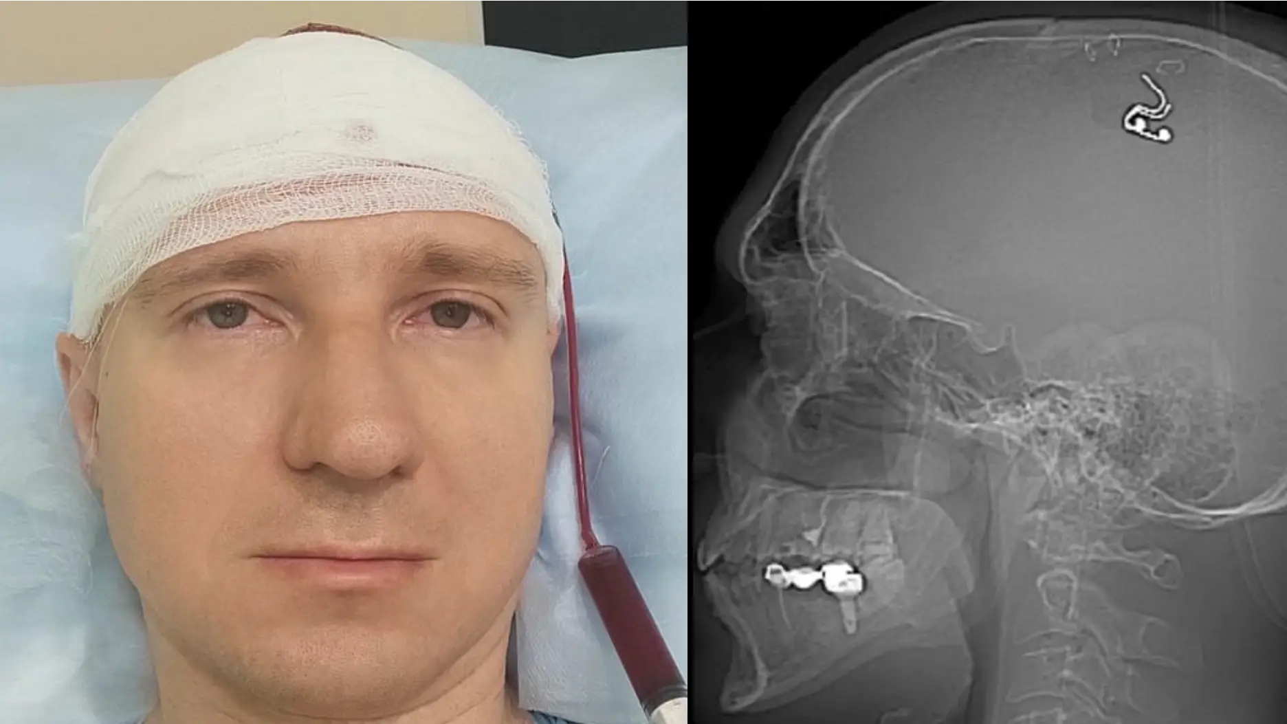 Instagram/@michael_raduga