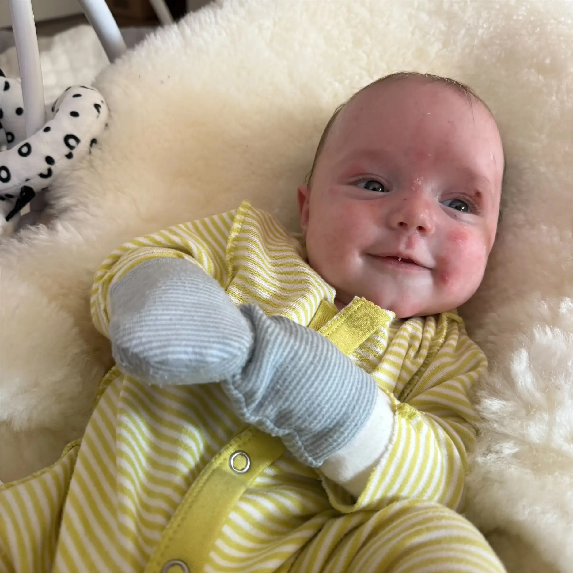 Ciara wants to raise awareness. (PA Real Life)