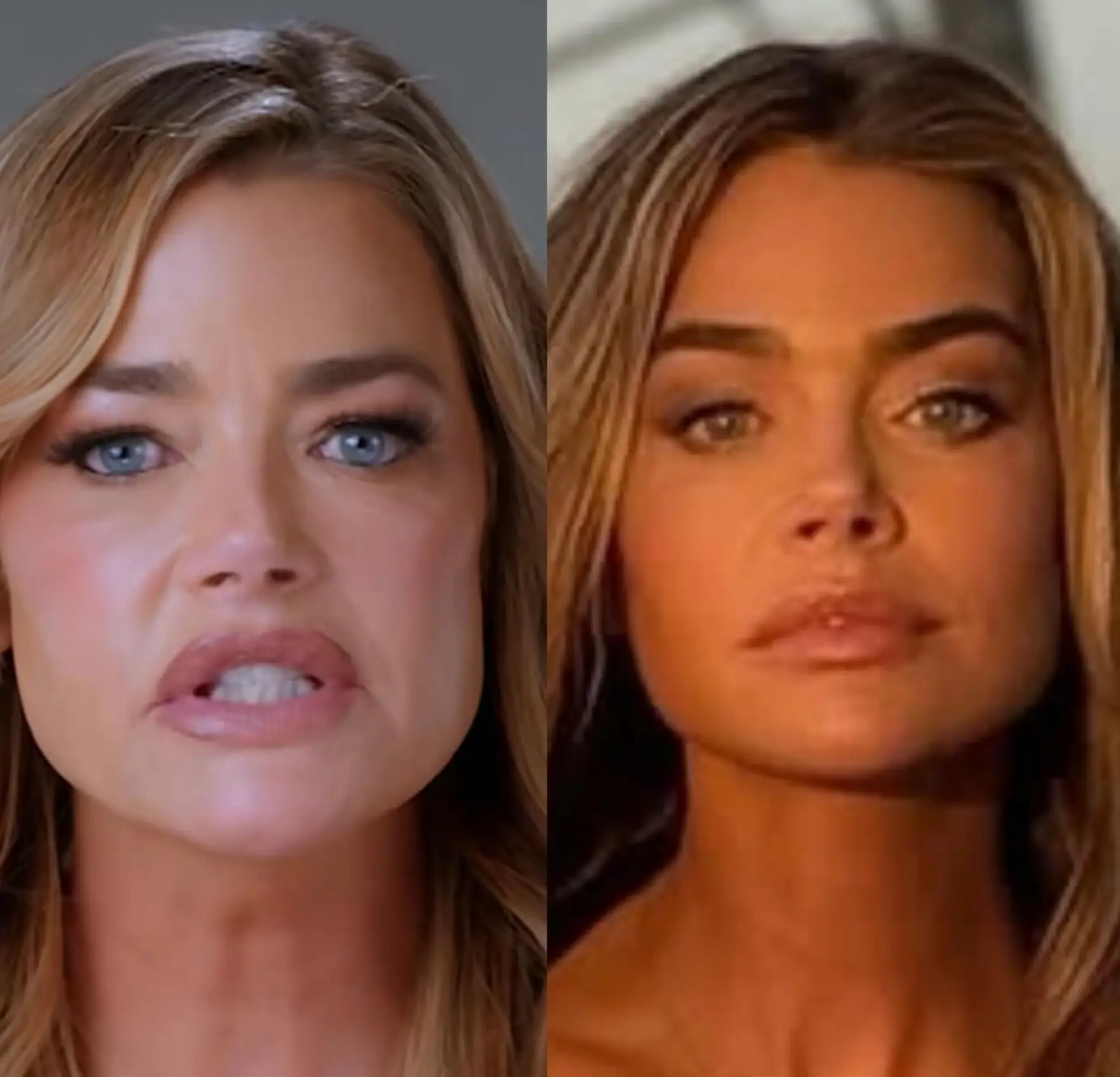 The actress, 55, underwent the cosmetic procedure eight months ago (Instagram/@drbentalei)