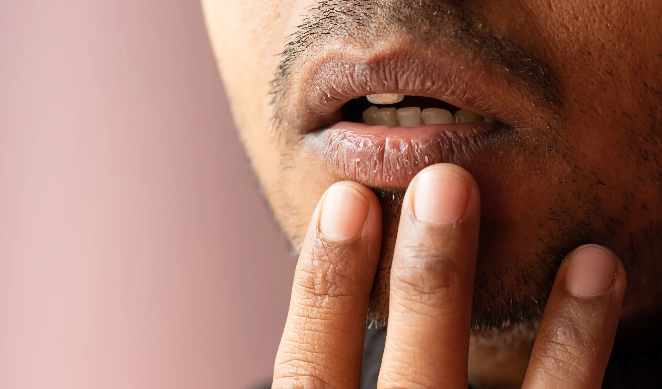 Chapped lips are usually only concerning if they are persistent or getting worse. (Getty Stock Images)