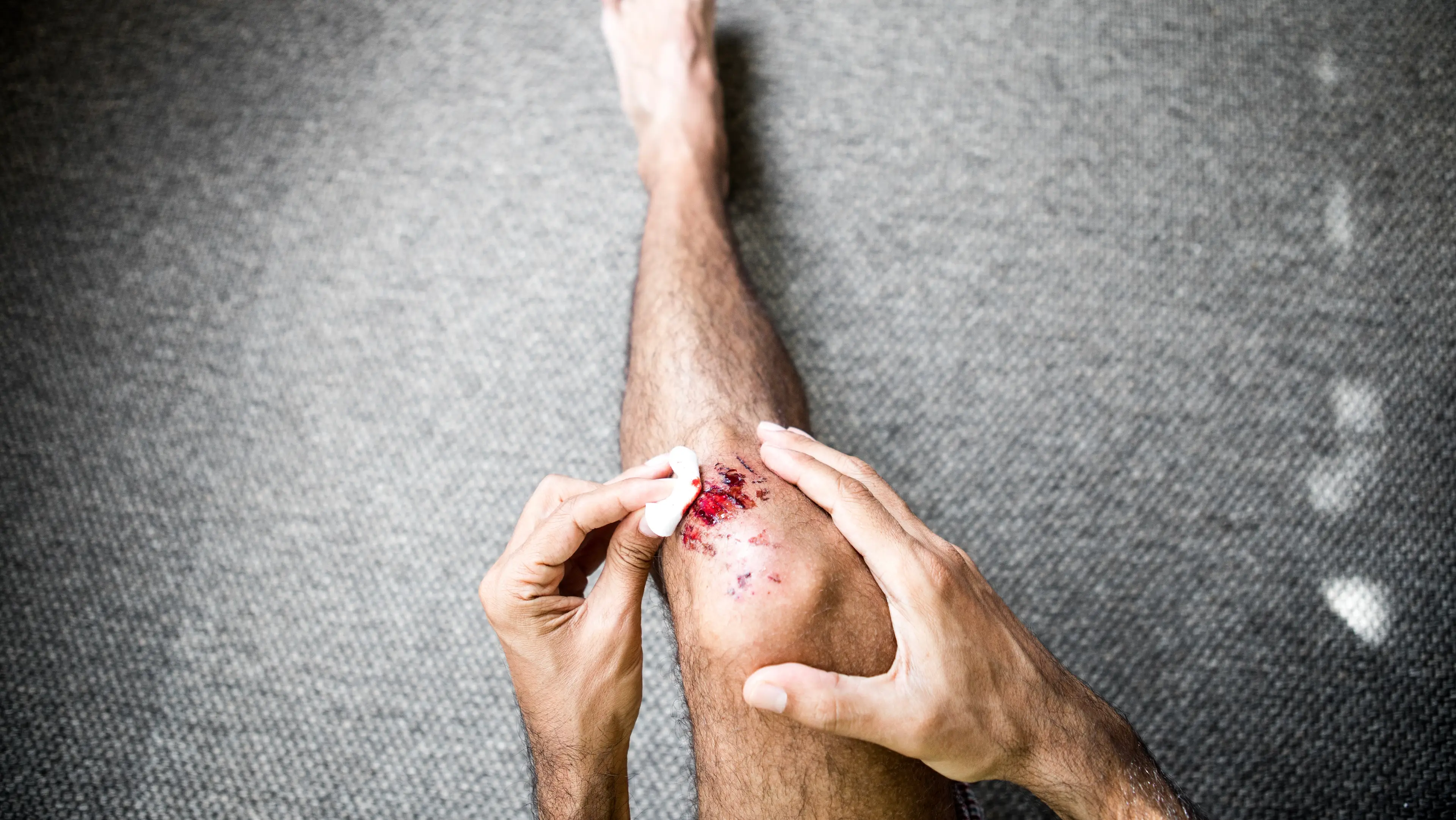 Haemophilia B is caused by a caused by a deficiency in a protein which allows our blood to clot (Getty Stock Image)