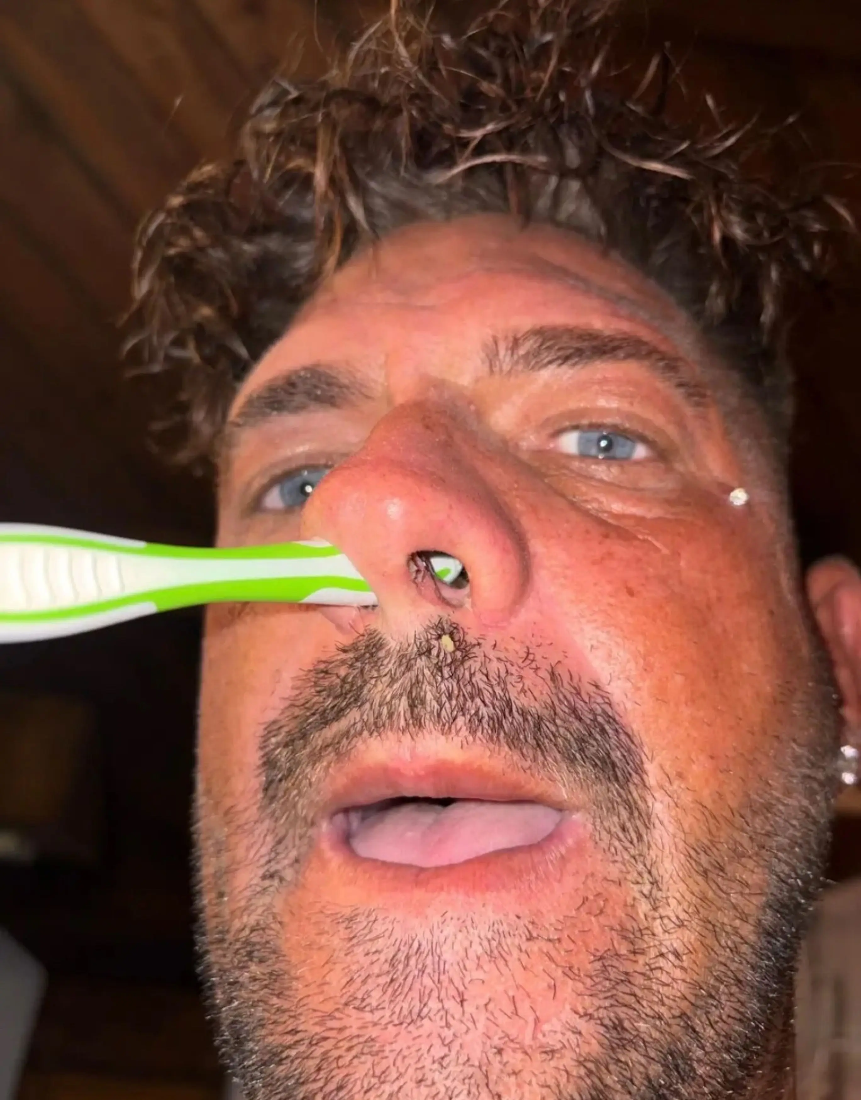 Lee has a hole in his septum (Kennedy News and Media)
