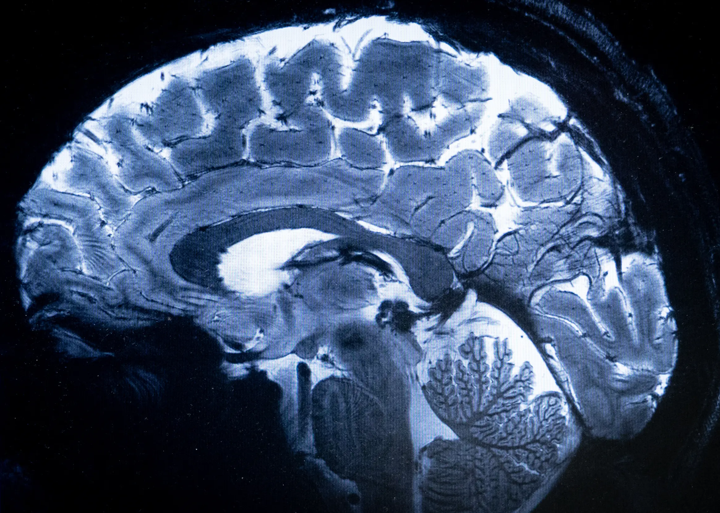 An MRI scan shows what our brain looks like. (ALAIN JOCARD/AFP via Getty Images)