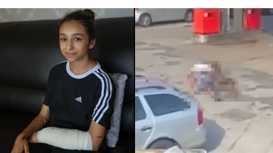 11-year-old who was mauled by XL bully bravely speaks out