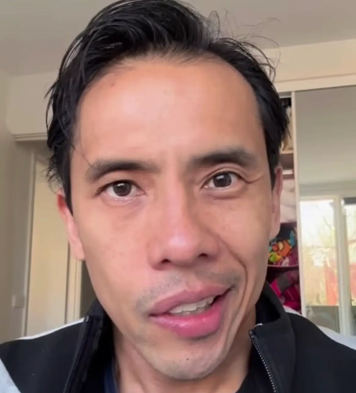 He's since shared an update confirming he has Bell's palsy (Instagram/@iskraznews)