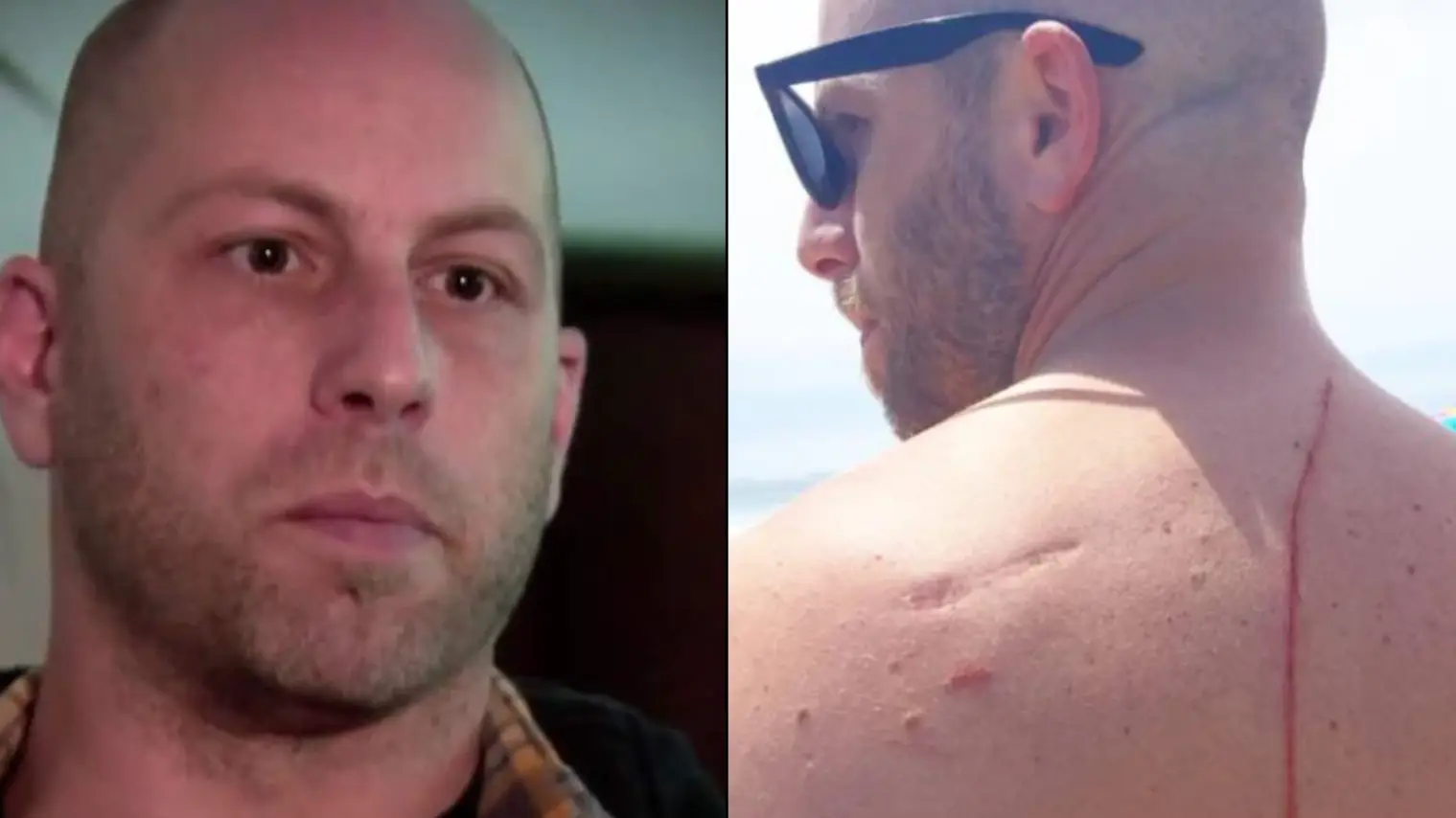 Man Likely Attacked By Shark Ends Up Having His Life Saved By It A Week Later