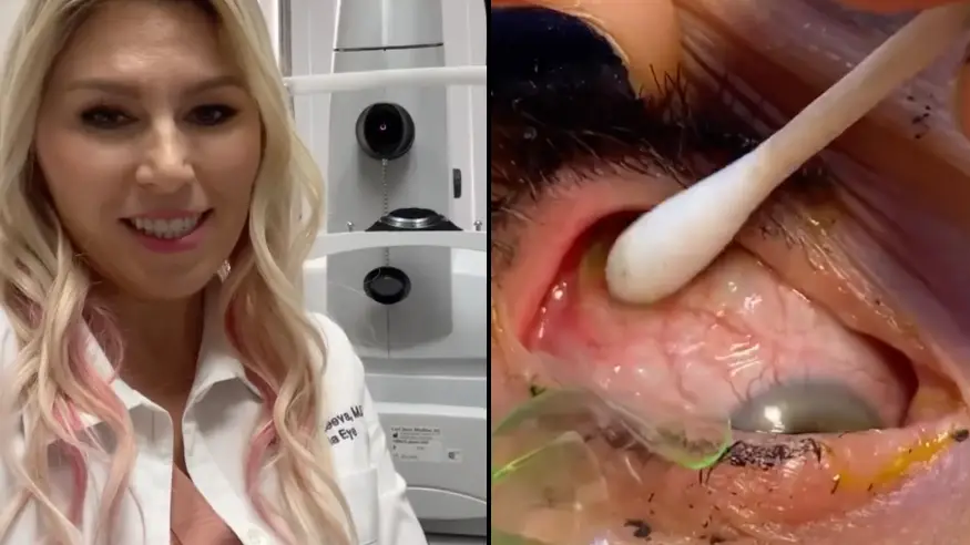 Instagram/california_eye_associates