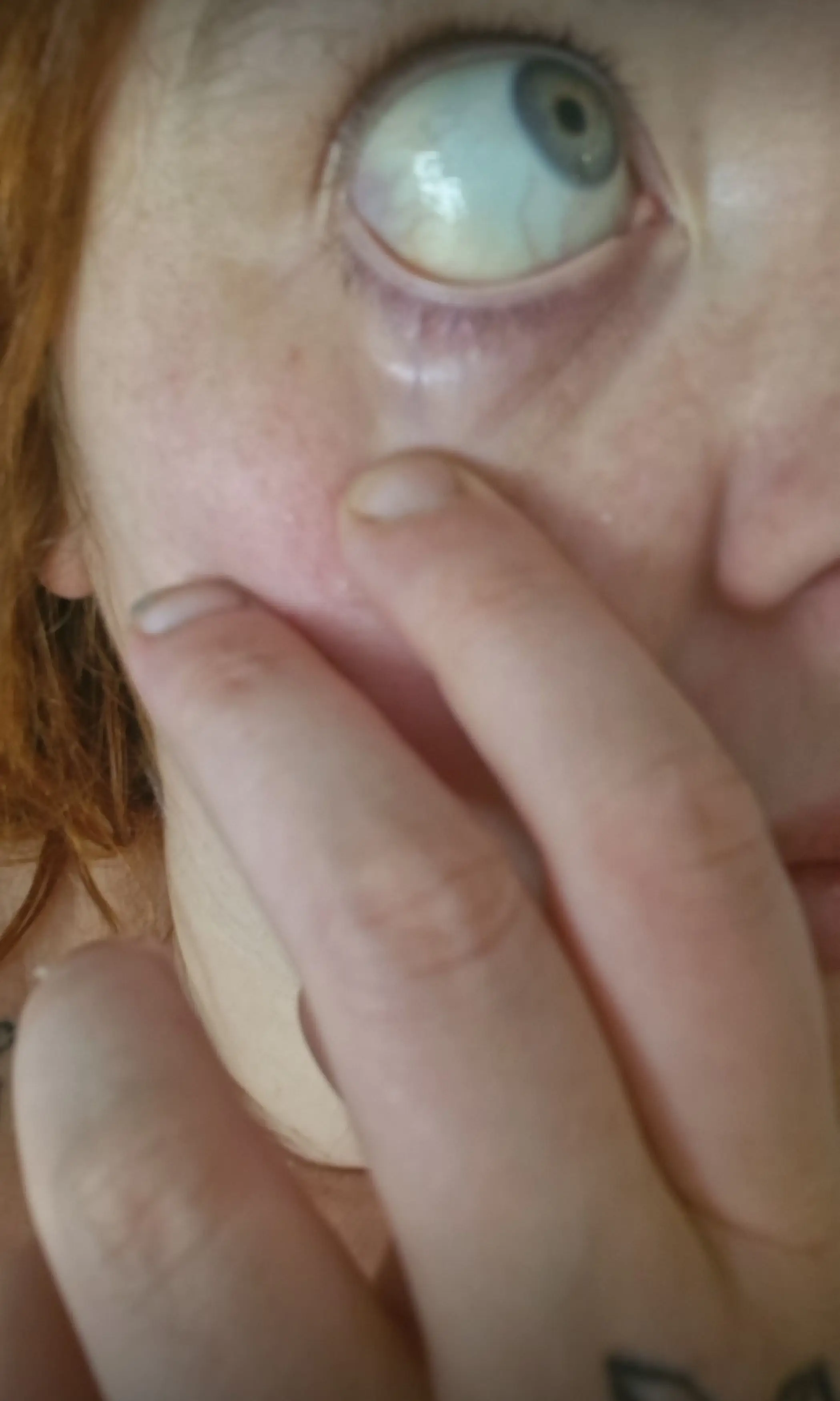 Jane had yellow eyes and brown urine as a result of the jabs (Kennedy News and Media)