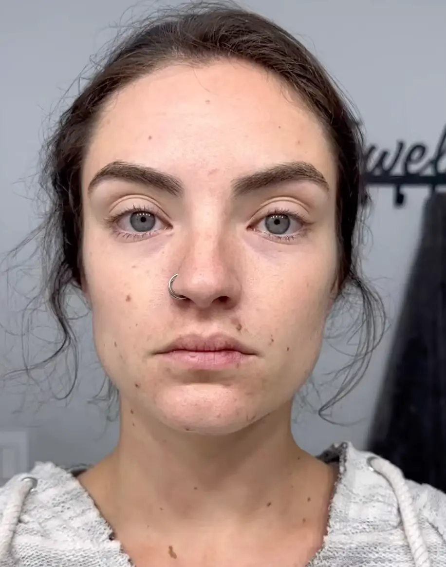 Paige documented the change in her face over the 30 day period (YouTube/yogawithpaige)