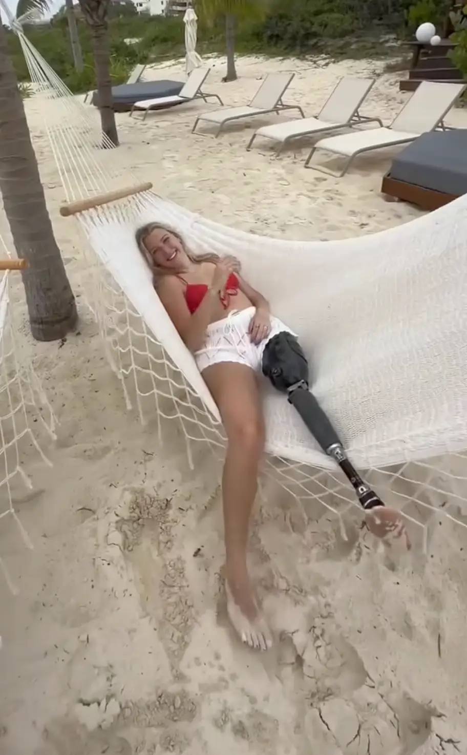 While her friends recovered, Kennedy's injuries were much more severe (Instagram/@_kickitkenny_9)