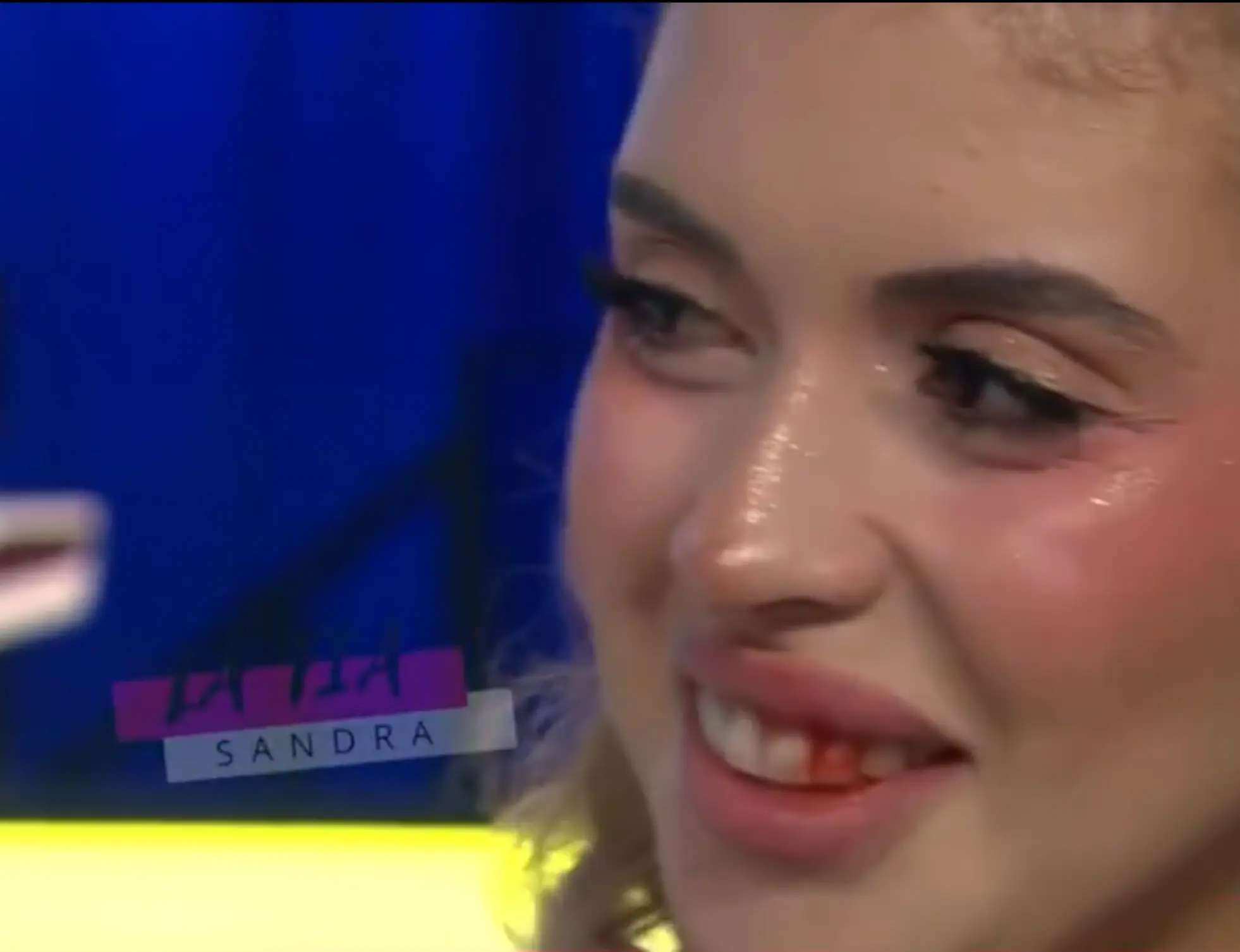 She returned to the show showing off her wound (ES Show)