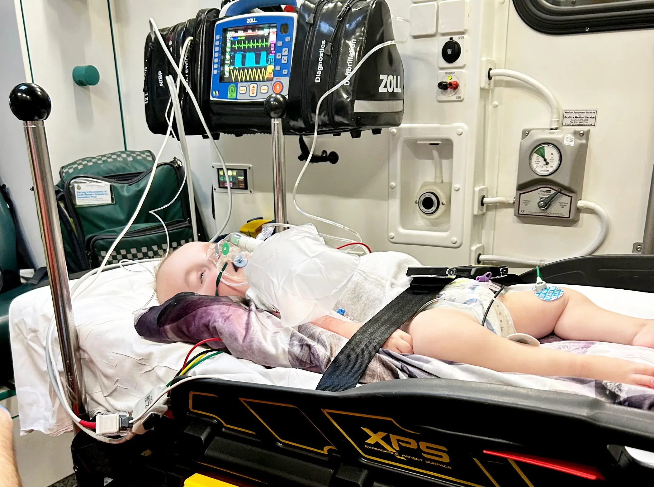 Drae suffers with a number of health conditions as a result of his disorder (SWNS)