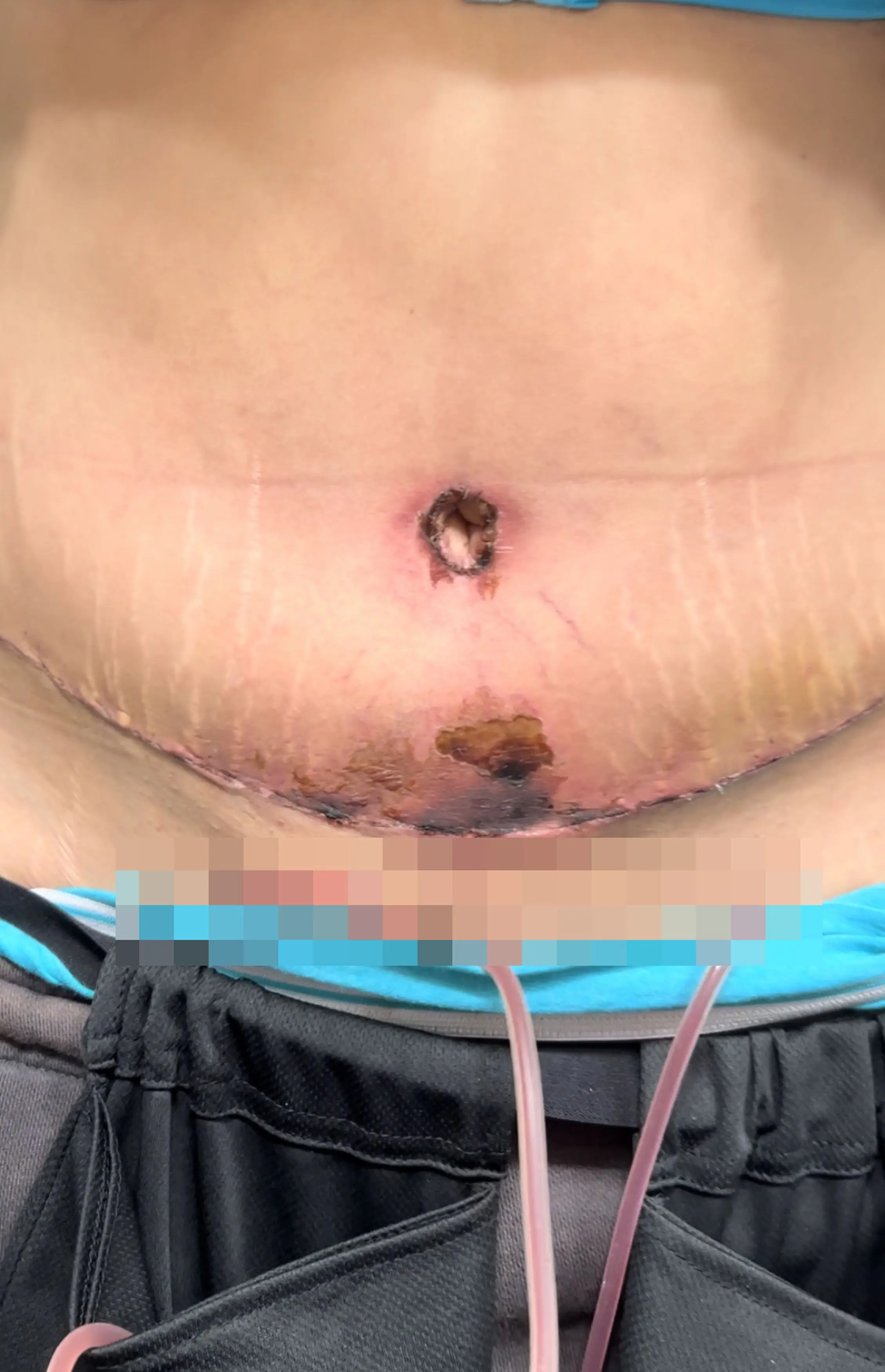 The 38-year-old Erica Zaccone has warned others to 'think twice' before having plastic surgery (Kennedy News and Media)